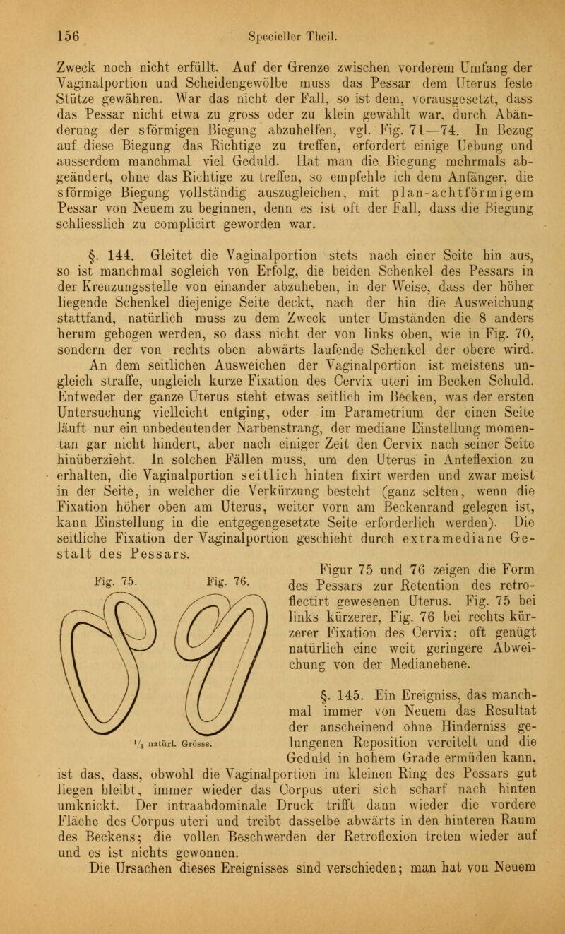 Zweck noch nicht erfüllt. Auf der Grenze zwischen vorderem Umfang der Vaginalportion und Scheidengewölbe muss das Pessar dem Uterus feste Stütze gewähren. War das nicht der Fall, so ist dem, vorausgesetzt, dass das Pessar nicht etwa zu gross oder zu klein gewählt war, durch Abän- derung der sförmigen Biegung abzuhelfen, vgl. Fig. 71—74. In Bezug auf diese Biegung das Richtige zu treffen, erfordert einige Uebung und ausserdem manchmal viel Geduld. Hat man die Biegung mehrmals ab- geändert, ohne das Richtige zu treffen, so empfehle ich dem Anfänger, die sförmige Biegung vollständig auszugleichen, mit plan-achtförmigem Pessar von Neuem zu beginnen, denn es ist oft der Fall, dass die Biegung schliesslich zu complicirt geworden war. §. 144. Gleitet die Vaginalportion stets nach einer Seite hin aus, so ist manchmal sogleich von Erfolg, die beiden Schenkel des Pessars in der Kreuzungsstelle von einander abzuheben, in der Weise, dass der höher liegende Schenkel diejenige Seite deckt, nach der hin die Ausweichung stattfand, natürlich muss zu dem Zweck unter Umständen die 8 anders herum gebogen werden, so dass nicht der von links oben, wie in Fig. 70, sondern der von rechts oben abwärts laufende Schenkel der obere wird. An dem seitlichen Ausweichen der Vaginalportion ist meistens un- gleich straffe, ungleich kurze Fixation des Cervix uteri im Becken Schuld. Entweder der ganze Uterus steht etwas seitlich im Becken, was der ersten Untersuchung vielleicht entging, oder im Parametrium der einen Seite läuft nur ein unbedeutender Narbenstrang, der mediane Einstellung momen- tan gar nicht hindert, aber nach einiger Zeit den Cervix nach seiner Seite hinüberzieht. In solchen Fällen muss, um den Uterus in Anteflexion zu erhalten, die Vaginalportion seitlich hinten fixirt werden und zwar meist in der Seite, in welcher die Verkürzung besteht (ganz selten, wenn die Fixation höher oben am Uterus, weiter vorn am Beckenrand gelegen ist, kann Einstellung in die entgegengesetzte Seite erforderlich werden). Die seitliche Fixation der Vaginalportion geschieht durch extramediane Ge- stalt des Pessars. Figur 75 und 76 zeigen die Form des Pessars zur Retention des retro- flectirt gewesenen Uterus. Fig. 75 bei links kürzerer, Fig. 76 bei rechts kür- zerer Fixation des Cervix; oft genügt natürlich eine weit geringere Abwei- 1', natürl. Grösse. chung von der Medianebene. §. 145. Ein Ereigniss, das manch- mal immer von Neuem das Resultat der anscheinend ohne Hinderniss ge- lungenen Reposition vereitelt und die Geduld in hohem Grade ermüden kann, ist das, dass, obwohl die Vaginalportion im kleinen Ring des Pessars gut liegen bleibt, immer wieder das Corpus uteri sich scharf nach hinten umknickt. Der intraabdominale Druck trifft dann wieder die vordere Fläche des Corpus uteri und treibt dasselbe abwärts in den hinteren Raum des Beckens; die vollen Beschwerden der Retroflexion treten wieder auf und es ist nichts gewonnen. Die Ursachen dieses Ereignisses sind verschieden; man hat von Neuem