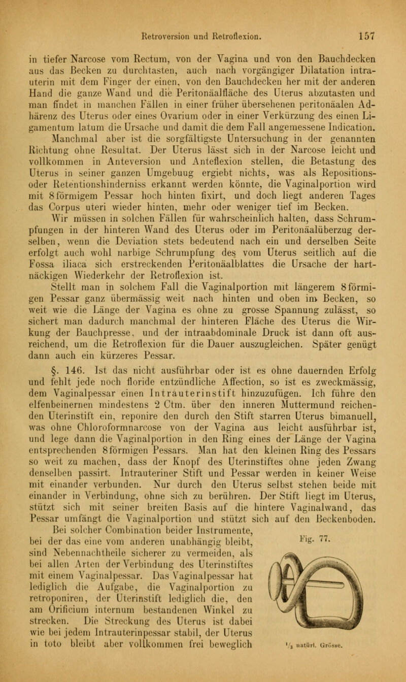 in tiefer Narcose vom Rectum, von der Vagina und von den Bauchdecken aus das Becken zu durchtasten, auch nach vorgängiger Dilatation intra- uterin mit dem Pinger der einen, von den Bauchdecken her mit der anderen Hand die ganze Wand und die Peritonäalfläche des Uterus abzutasten und man findet in manchen Fällen in einer früher übersehenen peritonäalen Ad- härenz des Uteras oder eines Ovarium oder in einer Verkürzung des einen Li- gamentum latum die Ursache und damit die dem Fall angemessene Indication. Manchmal aber ist die sorgfältigste Untersuchung in der genannten Richtung ohne Resultat. Der Uterus lässt sich in der Narcose leicht und vollkommen in Anteversion und Anteflexion stellen, die Betastung des Uterus in seiner ganzen Umgebuug ergiebt nichts, was als Repositions- oder Retentionshinderniss erkannt werden könnte, die Vaginalportion wird mit 8 förmigem Pessar hoch hinten fixirt, und doch liegt anderen Tages das Corpus uteri wieder hinten, mehr oder weniger tief im Becken. Wir müssen in solchen Fällen für wahrscheinlich halten, dass Schrum- pfungen in der hinteren Wand des Uterus oder im Peritonäalüberzug der- selben, wenn die Deviation stets bedeutend nach ein und derselben Seite erfolgt auch wohl narbige Schrumpfung des vom Uterus seitlich auf die Fossa iliaca sich erstreckenden Peritonäalblattes die Ursache der hart- näckigen Wiederkehr der Retroflexion ist. Stellt man in solchem Fall die Vaginalportion mit längerem 8 förmi- gen Pessar ganz übermässig weit nach hinten und oben im Becken, so weit wie die Länge der Vagina es ohne zu grosse Spannung zulässt, so sichert man dadurch manchmal der hinteren Fläche des Uterus die Wir- kung der Bauchpresse, und der intraabdominale Druck ist dann oft aus- reichend, um die Retroflexion für die Dauer auszugleichen. Später genügt dann auch ein kürzeres Pessar. §. 146. Ist das nicht ausführbar oder ist es ohne dauernden Erfolg und fehlt jede noch floride entzündliche Affection, so ist es zweckmässig, dem Vaginalpessar einen Intrauterinstift hinzuzufügen. Ich führe den elfenbeinernen mindestens 2 Ctm. über den inneren Muttermund reichen- den Uterinstift ein, reponire den durch den Stift starren Uterus bimanuell, was ohne Chloroformnarcose von der Vagina aus leicht ausführbar ist, und lege dann die Vaginalportion in den Ring eines der Länge der Vagina entsprechenden 8 förmigen Pessars. Man hat den kleinen Ring des Pessars so weit zu machen, dass der Knopf des Uterinstiftes ohne jeden Zwang denselben passirt. Intrauteriner Stift und Pessar werden in keiner Weise mit einander verbunden. Nur durcli den Uterus selbst stehen beide mit einander in Verbindung, ohne sich zu berühren. Der Stift liegt im Uterus, stützt sich mit seiner breiten Basis auf die hintere Vaginalwand, das Pessar umfängt die Vaginalportion und stützt sich auf den Beckenboden. Bei solcher Combination beider Instrumente, bei der das eine vom anderen anabhängig bleibt, £• 77- sind Nebennachtheile sicherer zu vermeiden, als bei allen Arten der Verbindung des Uterinstiftes mit einem Vaginalpessar. Das Vaginalpessar hat lediglich die Aufgabe, die Vaginalportion zu relroponircn, der Uterinstift lediglich die, den am Orificium internum bestandenen Winkel zu strecken. Die Streckung des Uterus ist dabei wie bei jedem Intrauterinpessar stabil, der Uterus in toto bleibt aber vollkommen frei beweglich »/, n«tfri. Grösse.