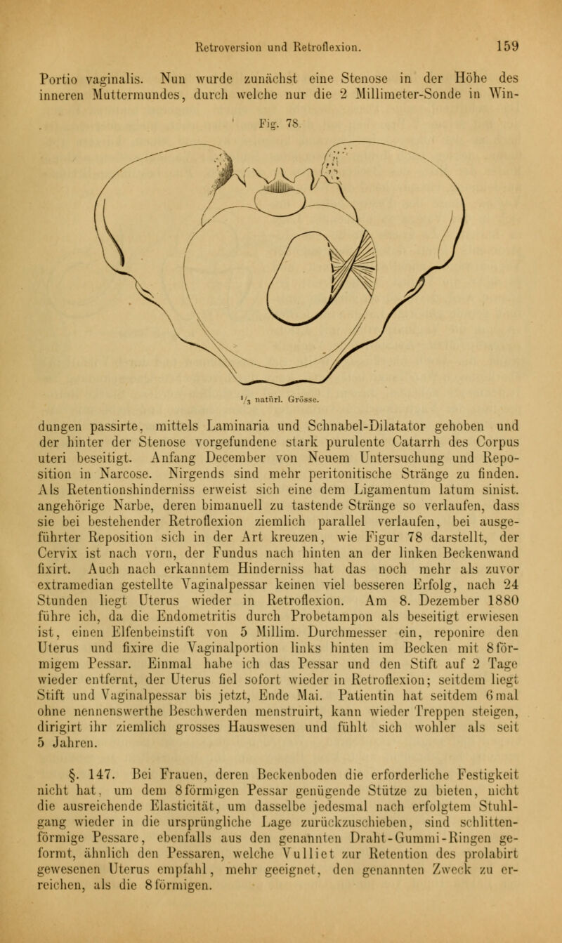 Portio vaginalis. Nun wurde zunächst eine Stenose in der Höhe des inneren Muttermundes, durch welche nur die 2 Millimeter-Sonde in Win- Fig. 78. i/3 natürl. Grösse. düngen passirte, mittels Laminaria und Schnabel-Dilatator gehoben und der hinter der Stenose vorgefundene stark purulente Catarrh des Corpus uteri beseitigt. Anfang December von Neuem Untersuchung und Repo- sition in Narcose. Nirgends sind mehr peritonitische Stränge zu finden. Als Retentionshinderniss erweist sich eine dem Ligamentum latum sinist. angehörige Narbe, deren bimanuell zu tastende Stränge so verlaufen, dass sie bei bestehender Retroflexion ziemlich parallel verlaufen, bei ausge- führter Reposition sich in der Art kreuzen, wie Figur 78 darstellt, der Cervix ist nach vorn, der Fundus nach hinten an der linken Beckenwand fixirt. Auch nach erkanntem Hinderniss hat das noch mehr als zuvor extramedian gestellte Vaginalpessar keinen viel besseren Erfolg, nach 24 Stunden liegt Uterus wieder in Retroflexion. Am 8. Dezember 1880 führe ich, da die Endometritis durch Probetampon als beseitigt erwiesen ist, einen Elfenbeinstift von 5 Millim. Durchmesser ein, reponire den Uterus und fixire die Vaginalportion links hinten im Becken mit 8för- migem Pessar. Einmal habe ich das Pessar und den Stift auf 2 Tage wieder entfernt, der Uterus fiel sofort wieder in Retroflexion; seitdem liegt Stift und Vaginalpessar bis jetzt, Ende Mai. Patientin hat seitdem 6mal ohne nennenswerthe Beschwerden menstrüirt, kann wieder Treppen steigen, dirigirt ihr ziemlich grosses Hauswesen und fühlt sich wohler als seit 5 Jahren. §. 147. Bei Frauen, deren Beckenboden die erforderliche Festigkeit nicht hat, um dem 8förmigen Pessar genügende Stütze zu bieten, nicht die ausreichende Elasticität, um dasselbe jedesmal nach erfolgtem Stuhl- gang wieder in die ursprüngliche Lage zurückzuschieben, sind schlitten- förmige Pessare, ebenfalls aus den genannten Draht-Gummi-Ringen ge- formt, ähnlich den Pessaren, welche Vulliet zur Retention des prolabirt gewesenen Uterus empfahl, mehr geeignet, den genannten Zweck zu er- reichen, als die 8förmigen.
