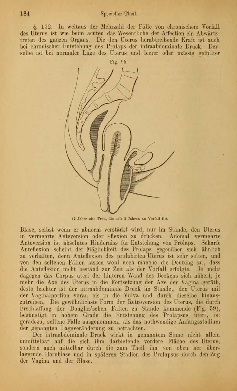 §. 172. In weitaus der Mehrzahl der Fälle von chronischem Vorfall des Uterus ist wie beim acuten das Wesentliche der Affection ein Abwärts- treten des ganzen Organs. Die den Uterus herabtreibende Kraft ist auch bei chronischer Entstehung des Prolaps der intraabdominale Druck. Der- selbe ist bei normaler Lage des Uterus und leerer oder massig gefüllter 95. Fig. 47 Jahre alte Frau, die seit 2 Jahren an Vorfall litt. Blase, selbst wenn er abnorm verstärkt wird, nur im Stande, den Uterus in vermehrte Anteversion oder -ilexion zu drücken. Anomal vermehrte Anteversion ist absolutes Hinderniss für Entstehung von Prolaps. Scharfe Anteflexion scheint der Möglichkeit des Prolaps gegenüber sich ähnlich zu verhalten, denn Anteflexion des prolabirten Uterus ist sehr selten, und von den seltenen Fällen lassen wohl noch manche die Deutung zu, dass die Anteflexion nicht bestand zur Zeit als der Vorfall erfolgte. Je mehr dagegen das Corpus uteri der hinteren Wand des Beckens sich nähert, je mehr die Axe des Uterus in die Fortsetzung der Axe der Vagina geräth, desto leichter ist der intraabdominale Druck im Stande, den Uterus mit der Vaginalportion voran bis in die Vulva und durch dieselbe hinaus- zutreiben. Die gewöhnlichste Form der Retroversion des Uterus, die durch Erschlaffung der Douglas'schen Falten zu Stande kommende (Fig. 59), begünstigt in hohem Grade die Entstehung des Prolapsus uteri, ist geradezu, seltene Fälle ausgenommen, als das nothwendige Anfangsstadium der genannten Lageveränderung zu betrachten. Der intraabdominale Druck wirkt in genanntem Sinne nicht allein unmittelbar auf die sich ihm darbietende vordere Fläche des Uterus, sondern auch mittelbar durch die zum Theil ihn von oben her über- lagernde Harnblase und in späteren Stadien des Prolapsus durch den Zug der Vagina und der Blase.