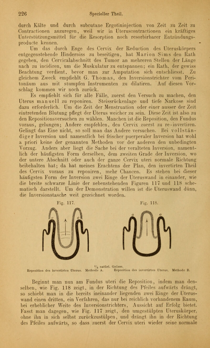 durch Kälte und durch subcutane Ergotininjection von Zeit Contractionen anzuregen, weil wir in Uteruscontractionen zu Zeit zu ■i->K ein kräftiges Unterstützungsmittel für die Resorption noch resorbirbarer Entzündungs- producte kennen. Um das durch Enge des Cervix der Reduction des Uteruskörpers entgegenstehende Hinderniss zu beseitigen, hat Marion Sims den Rath gegeben, den Cervicalabschnitt des Tumor an mehreren Stellen der Länge nach zu incidiren, um die Muskulatur zu entspannen; ein Rath, der gewiss Beachtung verdient, bevor man zur Amputation sich entschliesst. Zu gleichem Zweck empfiehlt G. Thomas, den Inversionstrichter vom Peri- tonäum aus mit stumpfen Instrumenten zu dilatiren. Auf diesen Vor- schlag kommen wir noch zurück. Es empfiehlt sich für alle Fälle, zuerst den Versuch zu machen, den Uterus manuell zu reponiren. Steissrückenlage und tiefe Narkose sind dazu erforderlich. Um die Zeit der Menstruation oder einer ausser der Zeit eintretenden Blutung pflegt der Uterus weicher zu sein. Diese Zeit ist also zu den Repositionsversuchen zu wählen. Manchen ist die Reposition, den Fundus voraus, gelungen; Andere empfehlen, den Cervix zuerst zu re-invertiren. Gelingt das Eine nicht, so soll man das Andere versuchen. Bei vollstän- diger Inversion und namentlich bei frischer puerperaler Inversion hat wohl a priori keine der genannten Methoden vor der anderen den unbedingten Vorzug. Anders aber liegt die Sache bei der veralteten Inversion, nament- lich der häufigsten Form derselben, dem zweiten Grade der Inversion, wo der untere Abschnitt oder auch der ganze Cervix uteri normale Richtung beibehalten hat; da hat meines Erachtens der Plan, den invertirten Theil des Cervix voraus zu reponiren, mehr Chancen. Es stehen bei dieser häufigsten Form der Inversion zwei Ringe der Uterus wand in einander, wie die breite schwarze Linie der nebenstehenden Figuren 117 und 118 sche- matisch darstellt. Um der Demonstration willen ist die Uteruswand dünn, die Inversionstasche weit gezeichnet worden. Für. ns. Reposition des invertirten Uterus. Methode A. Reposition des invertirten Uterus. Methode B. Beginnt man nun am Fundus uteri die Reposition, indem man den- selben, wie Fig. 118 zeigt, in der Richtung des Pfeiles aufwärts drängt, so schiebt man in die bereits ineinander liegenden zwei Ringe der Uterus- wand einen dritten, ein Verfahren, das nur bei reichlich vorhandenem Raum, bei erheblicher Weite des Inversionstrichters, Aussicht auf Erfolg bietet, Fasst man dagegen, wie Fig. 117 zeigt, den umgestülpten Uteruskörper, ohne ihn in sich selbst zurückzustülpen, und drängt ihn in der Richtung des Pfeiles aufwärts, so dass zuerst der Cervix uteri wieder seine normale