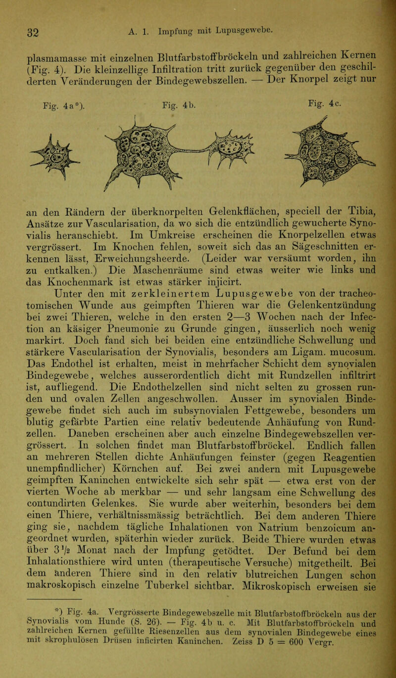 plasrnamasse mit einzelnen Blutfarbstoffbröckeln und zahlreichen Kernen (Fig. 4). Die kleinzellige Infiltration tritt zurück gegenüber den geschil- derten Veränderungen der Bindegewebszellen. — Der Knorpel zeigt nur Fig. 4a*). Fig. 4 b. Fig. 4 c. an den Rändern der überknorpelten Gelenkflächen, speciell der Tibia, Ansätze zur Vascularisation, da wo sich die entzündlich gewucherte Syno- vialis heranschiebt. Im Umkreise erscheinen die Knorpelzellen etwas vergrössert. Im Knochen fehlen, soweit sich das an Sägescbnitten er- kennen lässt, Erweichungsheerde. (Leider war versäumt worden, ihn zu entkalken.) Die Maschenräume sind etwas weiter wie links und das Knochenmark ist etwas stärker injicirt. Unter den mit zerkleinertem Lupusgewebe von der tracheo- tomischen Wunde aus geimpften Thieren war die Gelenkentzündung bei zwei Thieren, welche in den ersten 2—3 Wochen nach der Infec- tion an käsiger Pneumonie zu Grunde gingen, äusserlich noch wenig markirt. Doch fand sich bei beiden eine entzündliche Schwellung und stärkere Vascularisation der Synovialis, besonders am Ligam. mucosum. Das Endothel ist erhalten, meist in mehrfacher Schicht dem synovialen Bindegewebe, welches ausserordentlich dicht mit Rundzellen infiltrirt ist, aufliegend. Die Endothelzellen sind nicht selten zu grossen run- den und ovalen Zellen angeschwollen. Ausser im synovialen Binde- gewebe findet sich auch im subsynovialen Fettgewebe, besonders um blutig gefärbte Partien eine relativ bedeutende Anhäufung von Rund- zellen. Daneben erscheinen aber auch einzelne Bindegewebszellen ver- grössert. In solchen findet man Blutfarbstoffbrückel. Endlich fallen an mehreren Stellen dichte Anhäufungen feinster (gegen Reagentien unempfindlicher) Körnchen auf. Bei zwei andern mit Lupusgewebe geimpften Kaninchen entwickelte sich sehr spät — etwa erst von der vierten Woche ab merkbar — und sehr langsam eine Schwellung des contundirten Gelenkes. Sie wurde aber weiterhin, besonders bei dem einen Thiere, verhältnissmässig beträchtlich. Bei dem anderen Thiere ging sie, nachdem tägliche Inhalationen von Natrium benzoicum an- geordnet wurden, späterhin wieder zurück. Beide Thiere wurden etwas über 3'/2 Monat nach der Impfung getödtet. Der Befund bei dem Inhalationsthiere wird unten (therapeutische Versuche) mitgetheilt. Bei dem anderen Thiere sind in den relativ blutreichen Lungen schon makroskopisch einzelne Tuberkel sichtbar. Mikroskopisch erweisen sie *) Fig. 4a. Vergrösserte Bindegewebszelle mit Blutfarbstoffbröckeln aus der Synovialis vom Hunde (S. 26). — Fig. 4b u. c. Mit Blutfarbstoffbröckeln und zahlreichen Kernen gefüllte Riesenzellen aus dem synovialen Bindegewebe eines mit skroplmlösen Drüsen inficirten Kaninchen. Zeiss D 5 = 600 Vergr.