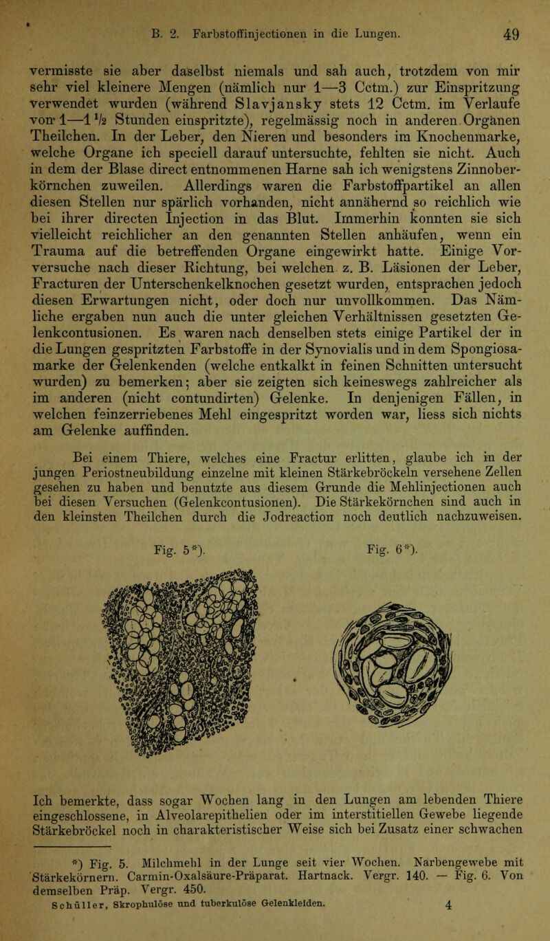 vermisste sie aber daselbst niemals und sah auch, trotzdem von mir sehr viel kleinere Mengen (nämlich nur 1—3 Cctm.) zur Einspritzung verwendet wurden (während Slavjansky stets 12 Cctm. im Verlaufe von-1—IV2 Stunden einspritzte), regelmässig noch in anderen Organen Theilchen. In der Leber, den Nieren und besonders im Knochenmarke, welche Organe ich speciell darauf untersuchte, fehlten sie nicht. Auch in dem der Blase direct entnommenen Harne sah ich wenigstens Zinnober- körnchen zuweilen. Allerdings waren die Farbstoffpartikel an allen diesen Stellen nur spärlich vorhanden, nicht annähernd so reichlich wie bei ihrer directen Injection in das Blut. Immerhin konnten sie sich vielleicht reichlicher an den genannten Stellen anhäufen, wenn ein Trauma auf die betreffenden Organe eingewirkt hatte. Einige Vor- versuche nach dieser Richtung, bei welchen z. B. Läsionen der Leber, Fracturen der Unterschenkelknochen gesetzt wurden, entsprachen jedoch diesen Erwartungen nicht, oder doch nur unvollkommen. Das Näm- liche ergaben nun auch die unter gleichen Verhältnissen gesetzten Ge- lenkcontusionen. Es waren nach denselben stets einige Partikel der in die Lungen gespritzten Farbstoffe in der Synovialis und in dem Spongiosa- marke der Gelenkenden (welche entkalkt in feinen Schnitten untersucht wurden) zu bemerken; aber sie zeigten sich keineswegs zahlreicher als im anderen (nicht contundirten) Gelenke. In denjenigen Fällen, in welchen feinzerriebenes Mehl eingespritzt worden war, liess sich nichts am Gelenke auffinden. Bei einem Thiere, welches eine Fractur erlitten, glaube ich in der jungen Periostneubildung einzelne mit kleinen Stärkebröckeln versehene Zellen gesehen zu haben und benutzte aus diesem Grunde die Mehlinjectionen auch bei diesen Versuchen (Gelenkcontusionen). Die Stärkekörnchen sind auch in den kleinsten Theilchen durch die Jodreaction noch deutlich nachzuweisen. Fig. 5*). Fig. 6*). Ich bemerkte, dass sogar Wochen lang in den Lungen am lebenden Thiere eingeschlossene, in Alveolarepithelien oder im interstitiellen Gewebe liegende Stärkebröckel noch in charakteristischer Weise sich bei Zusatz einer schwachen *) Fig. 5. Milchmehl in der Lunge seit vier Wochen. Narbengewebe mit 'Stärkekörnern. Carmin-Oxalsäure-Präparat. Hartnack. Vergr. 140. — Fig. 6. Von demselben Präp. Vergr. 450. Schüller, Skrophulöse und tuberkulöse Gelenklelden. 4