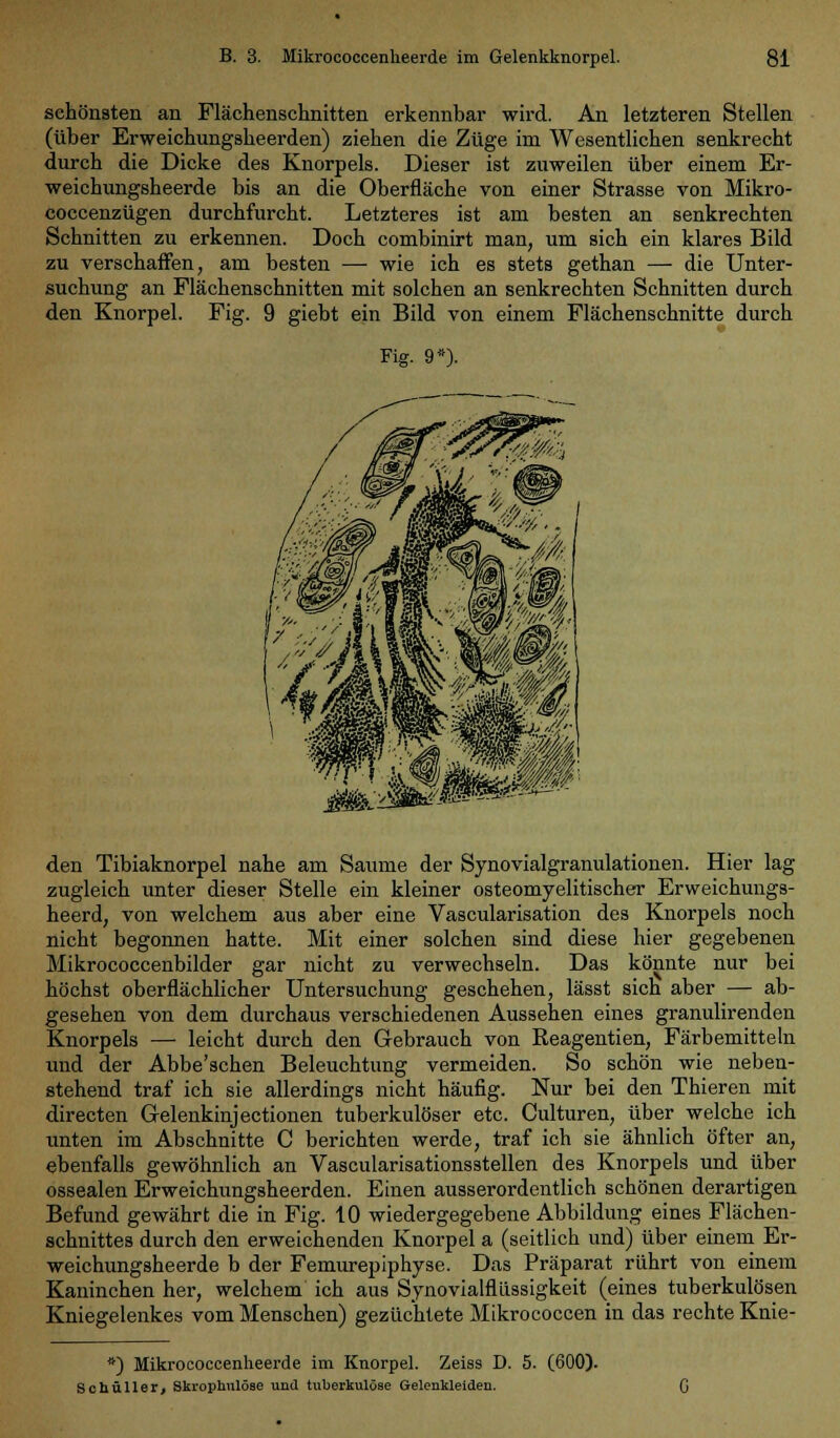 schönsten an Flächenschnitten erkennbar wird. An letzteren Stellen (über Erweichungsheerden) ziehen die Züge im Wesentlichen senkrecht durch die Dicke des Knorpels. Dieser ist zuweilen über einem Er- weichungsheerde bis an die Oberfläche von einer Strasse von Mikro- coccenzügen durchfurcht. Letzteres ist am besten an senkrechten Schnitten zu erkennen. Doch combinirt man, um sich ein klares Bild zu verschaffen, am besten — wie ich es stets gethan — die Unter- suchung an Flächenschnitten mit solchen an senkrechten Schnitten durch den Knorpel. Fig. 9 giebt ein Bild von einem Flächenschnitte durch Fig. 9*)- den Tibiaknorpel nahe am Saume der Synovialgranulationen. Hier lag zugleich unter dieser Stelle ein kleiner osteomyelitischer Erweichungs- heerd, von welchem aus aber eine Vascularisation des Knorpels noch nicht begonnen hatte. Mit einer solchen sind diese hier gegebenen Mikrococcenbilder gar nicht zu verwechseln. Das könnte nur bei höchst oberflächlicher Untersuchung geschehen, lässt sich aber — ab- gesehen von dem durchaus verschiedenen Aussehen eines granulirenden Knorpels — leicht durch den Gebrauch von Reagentien, Färbemitteln und der Abbe'schen Beleuchtung vermeiden. So schön wie neben- stehend traf ich sie allerdings nicht häufig. Nur bei den Thieren mit directen Gelenkinjectionen tuberkulöser etc. Culturen, über welche ich unten im Abschnitte C berichten werde, traf ich sie ähnlich öfter an, ebenfalls gewöhnlich an Vascularisationsstellen des Knorpels und über ossealen Erweichungsheerden. Einen ausserordentlich schönen derartigen Befund gewährt die in Fig. 10 wiedergegebene Abbildung eines Flächen- schnittes durch den erweichenden Knorpel a (seitlich und) über einem Er- weichungsheerde b der Femurepiphyse. Das Präparat rührt von einem Kaninchen her, welchem ich aus Synovialflüssigkeit (eines tuberkulösen Kniegelenkes vom Menschen) gezüchtete Mikrococcen in das rechte Knie- *) Mikroooccenheerde im Knorpel. Zeiss D. 5. (600). Schüller, Ski'ophulöse und Uiberkulöse Gelenkleiden.