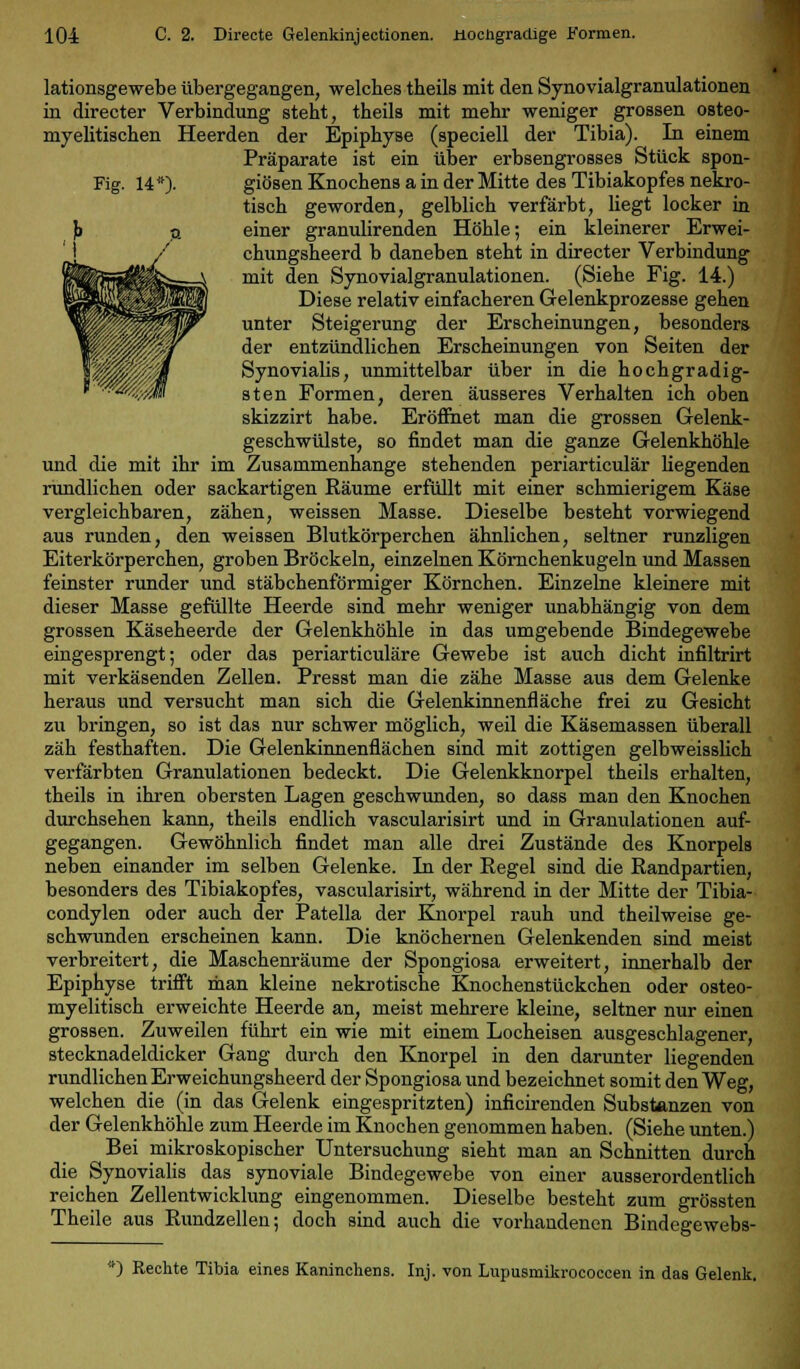 lationsgewebe übergegangen, welches theils mit den Synovialgranulationen in directer Verbindung steht, theils mit mehr weniger grossen osteo- myelitischen Heerden der Epiphyse (speciell der Tibia). In einem Präparate ist ein über erbsengrosses Stück spon- Fig. 14*)- giösen Knochens a in der Mitte des Tibiakopfes nekro- tisch geworden, gelblich verfärbt, liegt locker in einer granulirenden Höhle; ein kleinerer Erwei- chungsheerd b daneben steht in directer Verbindung mit den Synovialgranulationen. (Siehe Fig. 14.) Diese relativ einfacheren Gelenkprozesse gehen unter Steigerung der Erscheinungen, besonders der entzündlichen Erscheinungen von Seiten der Synovialis, unmittelbar über in die hochgradig- sten Formen, deren äusseres Verhalten ich oben skizzirt habe. Eröffnet man die grossen Gelenk- geschwülste, so findet man die ganze Gelenkhöhle und die mit ihr im Zusammenhange stehenden periarticulär liegenden rundlichen oder sackartigen Räume erfüllt mit einer schmierigem Käse vergleichbaren, zähen, weissen Masse. Dieselbe besteht vorwiegend aus runden, den weissen Blutkörperchen ähnlichen, seltner runzligen Eiterkörperchen, groben Bröckeln, einzelnen Körnchenkugeln und Massen feinster runder und stäbchenförmiger Körnchen. Einzelne kleinere mit dieser Masse gefüllte Heerde sind mehr weniger unabhängig von dem grossen Käseheerde der Gelenkhöhle in das umgebende Bindegewebe eingesprengt; oder das periarticuläre Gewebe ist auch dicht infiltrirt mit verkäsenden Zellen. Presst man die zähe Masse aus dem Gelenke heraus und versucht man sich die Gelenkinnenfläche frei zu Gesicht zu bringen, so ist das nur schwer möglich, weil die Käsemassen überall zäh festhaften. Die Gelenkinnenflächen sind mit zottigen gelbweisslich verfärbten Granulationen bedeckt. Die Gelenkknorpel theils erhalten, theils in ihren obersten Lagen geschwunden, so dass man den Knochen durchsehen kann, theils endlich vascularisirt und in Granulationen auf- gegangen. Gewöhnlich findet man alle drei Zustände des Knorpels neben einander im selben Gelenke. In der Regel sind die Randpartien, besonders des Tibiakopfes, vascularisirt, während in der Mitte der Tibia- condylen oder auch der Patella der Knorpel rauh und theilweise ge- schwunden erscheinen kann. Die knöchernen Gelenkenden sind meist verbreitert, die Maschenräume der Spongiosa erweitert, innerhalb der Epiphyse trifft man kleine nekrotische Knochenstückchen oder osteo- myelitisch erweichte Heerde an, meist mehrere kleine, seltner nur einen grossen. Zuweilen führt ein wie mit einem Locheisen ausgeschlagener, stecknadeldicker Gang durch den Knorpel in den darunter liegenden rundlichen Erweichungsheerd der Spongiosa und bezeichnet somit den Weg, welchen die (in das Gelenk eingespritzten) inficirenden Substanzen von der Gelenkhöhle zum Heerde im Knochen genommen haben. (Siehe unten.) Bei mikroskopischer Untersuchung sieht man an Schnitten durch die Synovialis das synoviale Bindegewebe von einer ausserordentlich reichen Zellentwicklung eingenommen. Dieselbe besteht zum grössten Theile aus Rundzellen; doch sind auch die vorhandenen Bindegewebs- *) Rechte Tibia eines Kaninchens. Inj. von Lupusmikrococcen in das Gelenk.