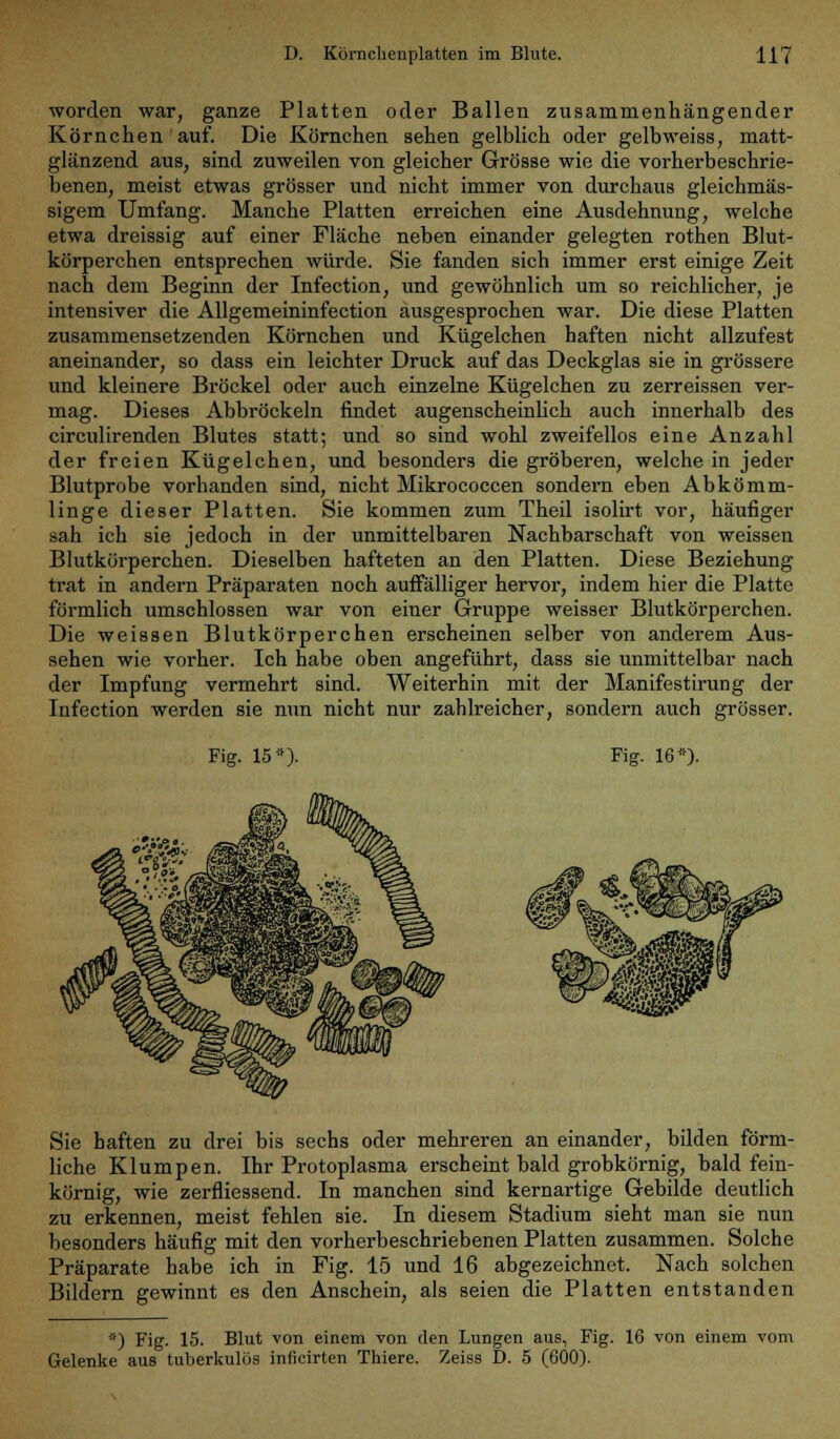 worden war, ganze Platten oder Ballen zusammenhängender Körnchen auf. Die Körnchen sehen gelblich oder gelbweiss, matt- glänzend aus, sind zuweilen von gleicher Grösse wie die vorherbeschrie- benen, meist etwas grösser und nicht immer von durchaus gleichmäs- sigem Umfang. Manche Platten erreichen eine Ausdehnung, welche etwa dreissig auf einer Fläche neben einander gelegten rothen Blut- körperchen entsprechen würde. Sie fanden sich immer erst einige Zeit nach dem Beginn der Infection, und gewöhnlich um so reichlicher, je intensiver die Allgemeininfection ausgesprochen war. Die diese Platten zusammensetzenden Körnchen und Kügelchen haften nicht allzufest aneinander, so dass ein leichter Druck auf das Deckglas sie in grössere und kleinere Bröckel oder auch einzelne Kügelchen zu zerreissen ver- mag. Dieses Abbröckeln findet augenscheinlich auch innerhalb des circulirenden Blutes statt; und so sind wohl zweifellos eine Anzahl der freien Kügelchen, und besonders die gröberen, welche in jeder Blutprobe vorhanden sind, nicht Mikrococcen sondern eben Abkömm- linge dieser Platten. Sie kommen zum Theil isolirt vor, häufiger sah ich sie jedoch in der unmittelbaren Nachbarschaft von weissen Blutkörperchen. Dieselben hafteten an den Platten. Diese Beziehung trat in andern Präparaten noch auffälliger hervor, indem hier die Platte förmlich umschlossen war von einer Gruppe weisser Blutkörperchen. Die weissen Blutkörperchen erscheinen selber von anderem Aus- sehen wie vorher. Ich habe oben angeführt, dass sie unmittelbar nach der Impfung vermehrt sind. Weiterhin mit der Manifestirung der Infection werden sie nun nicht nur zahlreicher, sondern auch grösser. Fig. 15*). Fig. 16»). Sie haften zu drei bis sechs oder mehreren an einander, bilden förm- liche Klumpen. Ihr Protoplasma erscheint bald grobkörnig, bald fein- körnig, wie zerfliessend. In manchen sind kernartige Gebilde deutlich zu erkennen, meist fehlen sie. In diesem Stadium sieht man sie nun besonders häufig mit den vorherbeschriebenen Platten zusammen. Solche Präparate habe ich in Fig. 15 und 16 abgezeichnet. Nach solchen Bildern gewinnt es den Anschein, als seien die Platten entstanden *) Fig. 15. Blut von einem von den Lungen aus, Fig. 16 von einem vom Gelenke aus tuberkulös inficirten Thiere. Zeiss D. 5 (600).