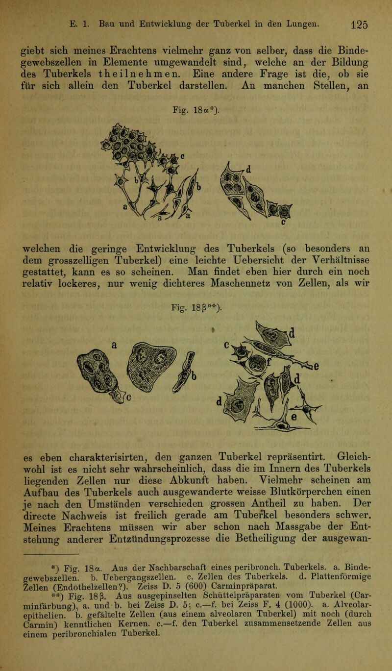 giebt sich meines Erachtens vielmehr ganz von selber, dass die Binde- gewebszellen in Elemente umgewandelt sind, welche an der Bildung des Tuberkels theilnehmen. Eine andere Frage ist die, ob sie für sich allein den Tuberkel darstellen. An manchen Stellen, an Fig. 18 ab- weichen die geringe Entwicklung des Tuberkels (so besonders an dem grosszelligen Tuberkel) eine leichte Uebersicht der Verhältnisse gestattet, kann es so scheinen. Man findet eben hier durch ein noch relativ lockeres, nur wenig dichteres Maschennetz von Zellen, als wir Fig. 18ß**>. es eben charakterisirten, den ganzen Tuberkel repräsentirt. Gleich- wohl ist es nicht sehr wahrscheinlich, dass die im Innern des Tuberkels liegenden Zellen nur diese Abkunft haben. Vielmehr scheinen am Aufbau des Tuberkels auch ausgewanderte weisse Blutkörperchen einen je nach den Umständen verschieden grossen Antheil zu haben. Der directe Nachweis ist freilich gerade am Tuberkel besonders schwer. Meines Erachtens müssen wir aber schon nach Massgabe der Ent- stehung anderer Entzündungsprozesse die Betheiligung der ausgewan- *) Fig. 18 a. Aus der Nachbarschaft eines peribronch. Tuberkels, a. Binde- gewebszellen, b. Uebergangszellen. c. Zellen des Tuberkels, d. Plattenförmige Zellen (Endothelzellen?). Zeiss D. 5 (600) Carminpräparat. **) Fig. 18 ß. Aus ausgepinselten Schüttelpräparaten vom Tuberkel (Car- miniarbung), a. und b. bei Zeiss D. 5; c—f. bei Zeiss F. 4 (1000). a. Alveolar- epithelien. b. gefältelte Zellen (aus einem alveolaren Tuberkel) mit noch (durch Carmin) kenntlichen Kernen, c.—f. den Tuberkel zusammensetzende Zellen aus einem peribronchialen Tuberkel.