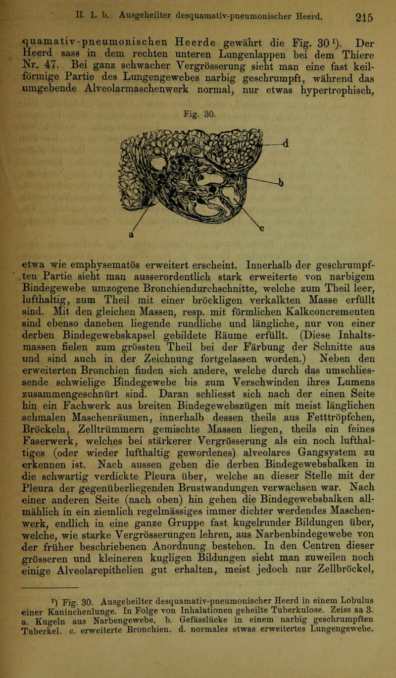 quamativ-pneumonischen Heerde gewährt die Fig. 30v). Der Heerd sass in dem rechten unteren Lungenlappen bei dem Thiere Nr. 47. Bei ganz schwacher Vergrösserung sieht man eine fast keil- förmige Partie des Lungengewebes narbig geschrumpft, während das umgebende Alveolarmaschenwerk normal, nur etwas hypertrophisch, Fig. 30. etwa wie emphysematös erweitert erscheint. Innerhalb der geschrumpf- .ten Partie sieht man ausserordentlich stark erweiterte von narbigem Bindegewebe umzogene Bronchiendurchschnitte, welche zum Theil leer, lufthaltig, zum Theil mit einer bröckligen verkalkten Masse erfüllt sind. Mit den gleichen Massen, resp. mit förmlichen Kalkconcrementen sind ebenso daneben liegende rundliche und längliche, nur von einer derben Bindegewebskapsel gebildete Räume erfüllt. (Diese Inhalts- massen fielen zum grössten Theil bei der Färbung der Schnitte aus und sind auch in der Zeichnung fortgelassen worden.) Neben den erweiterten Bronchien finden sich andere, welche durch das umschlies- sende schwielige Bindegewebe bis zum Verschwinden ihres Lumens zusammengeschnürt sind. Daran schliesst sich nach der einen Seite hin ein Fachwerk aus breiten Bindegewebszügen mit meist länglichen schmalen Maschenräumen, innerhalb dessen theils aus Fetttröpfchen, Bröckeln, Zelltrümmern gemischte Massen liegen, theils ein feines Faserwerk, welches bei stärkerer Vergrösserung als ein noch lufthal- tiges (oder wieder lufthaltig gewordenes) alveolares Gangsystem zu erkennen ist. Nach aussen gehen die derben Bindegewebsbalken in die schwartig verdickte Pleura über, welche an dieser Stelle mit der Pleura der gegenüberliegenden Brustwandungen verwachsen war. Nach einer anderen Seite (nach oben) hin gehen die Bindegewebsbalken all- mählich in ein ziemlich regelmässiges immer dichter werdendes Maschen- werk, endlich in eine ganze Gruppe fast kugelrunder Bildungen über, welche, wie starke Vergrösserungen lehren, aus Narbenbindegewebe von der früher beschriebenen Anordnung bestehen. In den Centren dieser grösseren und kleineren kugligen Bildungen sieht man zuweilen noch einige Alveolarepithelien gut erhalten, meist jedoch nur Zellbröckel, '■) Fig. 30. Ausgeheilter desquamativ-pneumonischer Heerd in einem Lobulus einer Kaninchenlunge. In Folge von Inhalationen geheilte Tuberkulose. Zeiss aa 3. a. Kugeln aus Narbengewebe, b. Gefässlücke in einem narbig geschrumpften Tuberkel, c. erweiterte Bronchien, d. normales etwas erweitertes Lungengewebe.