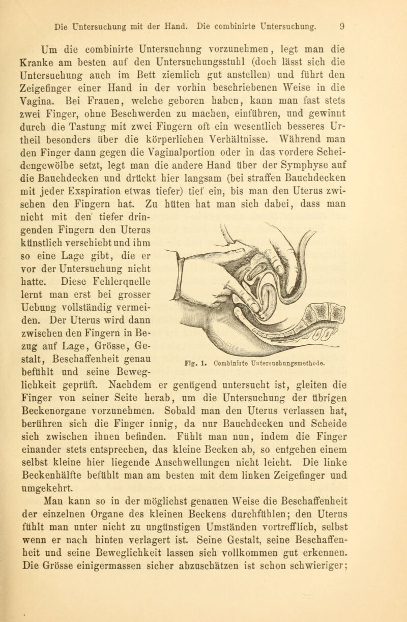Um die combinirte Untersuchung vorzunehmen, legt man die Kranke am besten auf den Untersuchungsstuhl (doch lässt sich die Untersuchung auch im Bett ziemlich gut anstellen) und führt den Zeigefinger einer Hand in der vorhin beschriebenen Weise in die Vagina. Bei Frauen, welche geboren haben, kann man fast stets zwei Finger, ohne Beschwerden zu machen, einführen, und gewinnt durch die Tastung mit zwei Fingern oft ein wesentlich besseres Ur- theil besonders über die körperlichen Verhältnisse. Während man den Finger dann gegen die Vaginalportion oder in das vordere Schei- dengewölbe setzt, legt man die andere Hand über der Symphyse auf die Bauchdecken und drückt hier langsam (bei straffen Bauchdecken mit jeder Exspiration etwas tiefer) tief ein, bis man den Uterus zwi- schen den Fingern hat. Zu hüten hat man sich dabei, dass man nicht mit den tiefer drin- genden Fingern den Uterus künstlich verschiebt und ihm so eine Lage gibt, die er vor der Untersuchung nicht hatte. Diese Fehlerquelle lernt man erst bei grosser Uebung vollständig vermei- den. Der Uterus wird dann zwischen den Fingern in Be- zug auf Lage, Grösse, Ge- stalt, Beschaffenheit genau befühlt und seine Beweg- lichkeit geprüft. Nachdem er genügend untersucht ist, gleiten die Finger von seiner Seite herab, um die Untersuchung der übrigen Beckenorgane vorzunehmen. Sobald man den Uterus verlassen hat, berühren sich die Finger innig, da nur Bauchdecken und Scheide sich zwischen ihnen befinden. Fühlt man nun, indem die Finger einander stets entsprechen, das kleine Becken ab, so entgehen einem selbst kleine hier liegende Anschwellungen nicht leicht. Die linke Beckenhälfte befühlt man am besten mit dem linken Zeigefinger und umgekehrt. Man kann so in der möglichst genauen Weise die Beschaffenheit der einzelnen Organe des kleinen Beckens durchfühlen; den Uterus fühlt man unter nicht zu ungünstigen Umständen vortrefflich, selbst wenn er nach hinten verlagert ist. Seine Gestalt, seine Beschaffen- heit und seine Beweglichkeit lassen sich vollkommen gut erkennen. Die Grösse einigermassen sicher abzuschätzen ist schon schwieriger; Fig. 1. Combinirte Uiitersuchungsmethode.