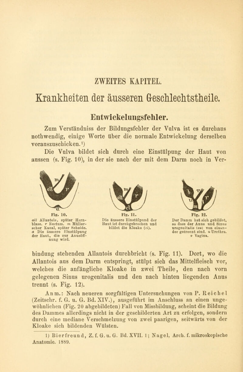 ZWEITES KAPITEL. Krankheiten der äusseren GescMechtstlieile. Entwlckelungsfehler. Zum Verständniss der Bildungsfehler der Vulva ist es durchaus nothwendig, einige Worte über die normale Entwickelung derselben vorauszuschicken.l) Die Vulva bildet sich durch eine Einstülpung der Haut von aussen (s. Fig. 10), in der sie nach der mit dem Darm noch in Ver- to Fi&. 10. Fi?. 11. Fi?. 12. all Allantois, später Harn- Die äussere Einstülpund der Der Damm hat sich gebildet, blase, r Rectum, m Müller- Haut ist durchgebrochen und so dass der Anus und Sinus scher Kanal, später Scheide. bildet die Kloake (cl). urogeuitalis (su) von einan- a Die äussere Einstülpung der getrennt sind, u Urethra. der Haut, die zur Anusöff- v Vagina, nung wird. bindung stehenden Allantois durchbricht (s. Fig. 11). Dort, wo die Allantois aus dem Darm entspringt, stülpt sich das Mittelfleisch vor, welches die anfängliche Kloake in zwei Theile, den nach vorn gelegenen Sinus urogenitalis und den nach hinten liegenden Anus trennt (s. Fig. 12). Anm.: Nach neueren sorgfältigen Untersuchungen von P. Reichel (Zeitschr. f. G-. u. G. Bd. XIV.), ausgeführt im Anschluss an einen unge- wöhnlichen (Fig. 20 abgebildeten) Fall von Missbildung, scheint die Bildung des Dammes allerdings nicht in der geschilderten Art zu erfolgen, sondern durch eine mediane Verschmelzung von zwei paarigen, seitwärts von der Kloake sich bildenden Wülsten. 1) Bierfreund, Z. f. G. u. G. Bd. XVII. 1; Nagel, Aren. f. mikroskopische Anatomie. 1889.