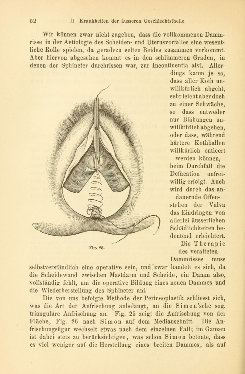 Wir können zwar nicht zugeben, dass die vollkommenen Damm- risse in der Aetiologie des Scheiden- und Uterusvorfalles eine wesent- liche Rolle spielen, da geradezu selten Beides zusammen vorkommt. Aber hiervon abgesehen kommt es in den schlimmeren Graden, in denen der Sphincter durchrissen war, zur Incontinentia alvi. Aller- dings kaum je so, dass aller Koth un- willkürlich abgeht, sehr leicht aber doch zu einer Schwäche, so dass entweder nur Blähungen un- willkürlich abgehen, oder dass, während härtere Kothballen willkürlich entleert werden können, beim Durchfall die Defäcation unfrei- willig erfolgt. Auch wird durch das an- dauernde Offen- stehen der Vulva das Eindringen von allerlei äusserlichen Schädlichkeiten be- deutend erleichtert. Die Therapie des veralteten Dammrisses muss selbstverständlich eine operative sein, und zwar handelt es sich, da die Scheidewand zwischen Mastdarm und Scheide, ein Damm also, vollständig fehlt, um die operative Bildung eines neuen Dammes und die Wiederherstellung des Sphincter ani. Die von uns befolgte Methode der Perineoplastik schliesst sich, was die Art der Anfrischung anbelangt, an die Simon'sche sog. trianguläre Anfrischung an. Fig. 25 zeigt die Anfrischung von der Fläche, Fig. 26 nach Simon auf dem Medianschnitt. Die An- frisch ungsfigur wechselt etwas nach dem einzelnen Fall; im Ganzen ist dabei stets zu berücksichtigen, was schon Simon betonte, dass es viel weniger auf die Herstellung eines breiten Dammes, als auf