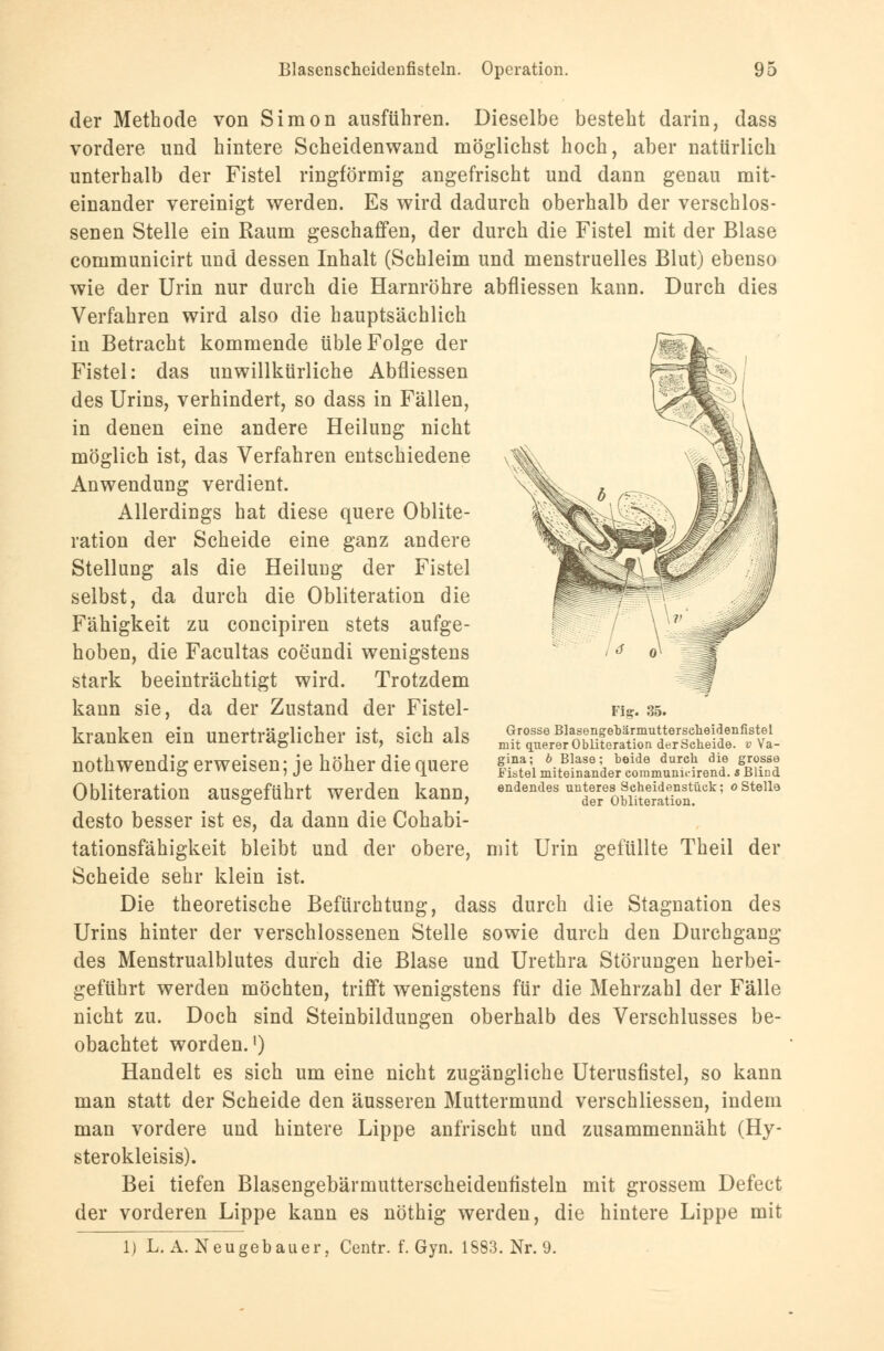 der Methode von Simon ausführen. Dieselbe besteht darin, dass vordere und hintere Scheidenwand möglichst hoch, aber natürlich unterhalb der Fistel ringförmig angefrischt und dann genau mit- einander vereinigt werden. Es wird dadurch oberhalb der verschlos- senen Stelle ein Raum geschaffen, der durch die Fistel mit der Blase communicirt und dessen Inhalt (Schleim und menstruelles Blut) ebenso wie der Urin nur durch die Harnröhre abfliessen kann. Durch dies Verfahren wird also die hauptsächlich in Betracht kommende üble Folge der Fistel: das unwillkürliche Abfliessen des Urins, verhindert, so dass in Fällen, in denen eine andere Heilung nicht möglich ist, das Verfahren entschiedene Anwendung verdient. Allerdings hat diese quere Oblite- ration der Scheide eine ganz andere Stellung als die Heilung der Fistel selbst, da durch die Obliteration die Fähigkeit zu concipiren stets aufge- hoben, die Facultas coeundi wenigstens stark beeinträchtigt wird. Trotzdem kann sie, da der Zustand der Fistel- kranken ein unerträglicher ist, sich als nothwendig erweisen; je höher die quere Obliteration ausgeführt werden kann, desto besser ist es, da dann die Cohabi- tationsfähigkeit bleibt und der obere, mit Urin gefüllte Theil der Scheide sehr klein ist. Die theoretische Befürchtung, dass durch die Stagnation des Urins hinter der verschlossenen Stelle sowie durch den Durchgang des Menstrualblutes durch die Blase und Urethra Störungen herbei- geführt werden möchten, trifft wenigstens für die Mehrzahl der Fälle nicht zu. Doch sind Steinbildungen oberhalb des Verschlusses be- obachtet worden.1) Handelt es sich um eine nicht zugängliche Uterusfistel, so kann man statt der Scheide den äusseren Muttermund verschliessen, indem man vordere und hintere Lippe anfrischt und zusammennäht (Hy- sterokleisis). Bei tiefen Blasengebärmutterscheidenfisteln mit grossem Defect der vorderen Lippe kann es nöthig werden, die hintere Lippe mit 1) L. A. Neugebauer, Centr. f. Gyn. 1S83. Nr. 9. Fig. 35. Grosse BlasengeDärmutterseheidenfistel mit querer Obliteration der Seheide, v Va- gina; 6 Blase; beide durch die grosse Fistel miteinander communnirend. s Blind endendes unteres Scheidenstück; o Stelle der Obliteration.
