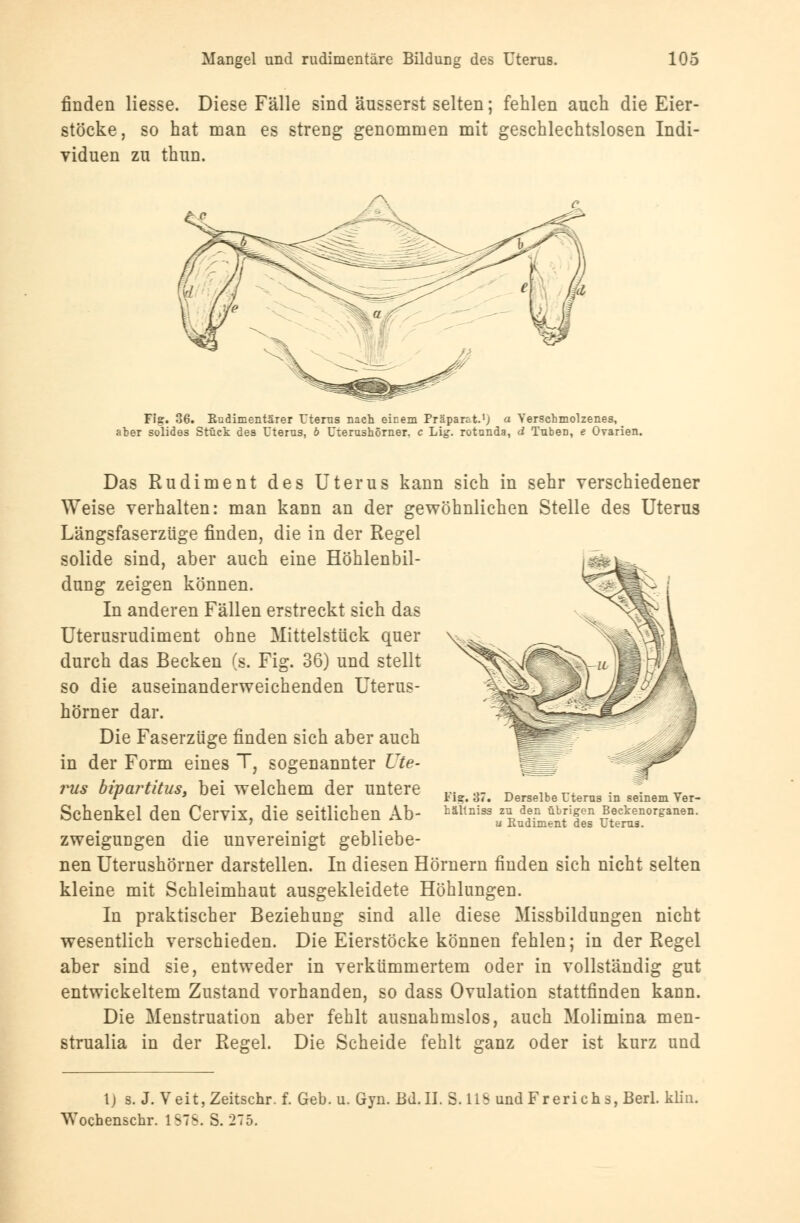 finden Hesse. Diese Fälle sind äusserst selten; fehlen auch die Eier- stöcke, so hat man es streng genommen mit geschlechtslosen Indi- viduen zu thun. Fis:. 36. Rudimentärer Uterus nach einem Präparr.t.1; a Verschmolzenes, aber solides Stück des Uterus, b Urerushörner. c Lig. rotunda, d Tuben, e Ovarien. Das Rudiment des Uterus kann sich in sehr verschiedener Weise verhalten: man kann an der gewöhnlichen Stelle des Uterus Längsfaserzüge finden, die in der Regel solide sind, aber auch eine Höhlenbil- dung zeigen können. In anderen Fällen erstreckt sich das Uterusrudiment ohne Mittelstück quer durch das Becken (s. Fig. 36) und stellt so die auseinanderweichenden Uterus- hörner dar. Die Faserzüge finden sich aber auch in der Form eines T, sogenannter Ute- rus bipartitus, bei welchem der untere Schenkel den Cervix, die seitlichen Ab- zweigungen die unvereinigt gebliebe- nen Uterushörner darstellen. In diesen Hörnern finden sich nicht selten kleine mit Schleimhaut ausgekleidete Höhlungen. In praktischer Beziehung sind alle diese Missbildungen nicht wesentlich verschieden. Die Eierstöcke können fehlen; in der Regel aber sind sie, entweder in verkümmertem oder in vollständig gut entwickeltem Zustand vorhanden, so dass Ovulation stattfinden kann. Die Menstruation aber fehlt ausnahmslos, auch Molimina men- strualia in der Regel. Die Scheide fehlt ganz oder ist kurz und Fi?. 37. Derselbe Uterus in seinem Ver- hältniss zu den übrigen Beckenorganen. u Rudiment des Uterus. t) s. J. Veit,Zeitschr. f. Geb. u. Gyn. Bd. IL S. HS und Frerichs, Berl. kliu. Wochenschr. 1878. S. 275.