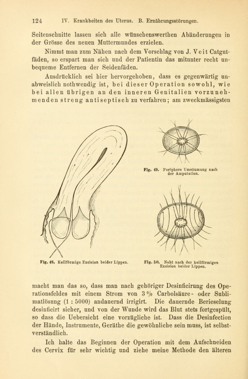 Seitenschnitte lassen sich alle wünschenswerthen Abänderungen in der Grösse des neuen Muttermundes erzielen. Nimmt man zum Nähen nach dem Vorschlag von J. Veit Catgut- fäden, so erspart man sich und der Patientin das mitunter recht un- bequeme Entfernen der Seidenfäden. Ausdrücklich sei hier hervorgehoben, dass es gegenwärtig un- abweislich nothwendig ist, bei dieser Operation sowohl, wie bei allen übrigen an den inneren Genitalien vorzuneh- menden streng antiseptisch zu verfahren; am zweckmässigsten Flg. 49. Periphere Umsäumung nach der Amputation. Fig. 48. Keilförmige Excision heider Lippen. Flg. 50. Naht nach der keilförmigen Excision beider Lippen. macht man das so, dass man nach gehöriger Desinficirung des Ope- rationsfeldes mit einem Strom von 3 °/o Carbolsäure- oder Subli- matlösung (1 : 5000) andauernd irrigirt. Die dauernde Berieselung desinh'cirt sicher, und von der Wunde wird das Blut stets fortgespült, so dass die Uebersicht eine vorzügliche ist. Dass die Desinfection der Hände, Instrumente, Geräthe die gewöhnliche sein muss, ist selbst- verständlich. Ich halte das Beginnen der Operation mit dem Aufschneiden des Cervix für sehr wichtig und ziehe meine Methode den älteren