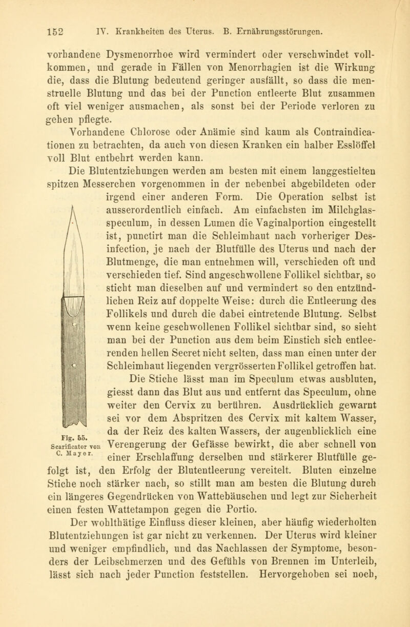 vorhandene Dysmenorrhoe wird vermindert oder verschwindet voll- kommen, und gerade in Fällen von Menorrhagien ist die Wirkung die, dass die Blutung bedeutend geringer ausfällt, so dass die men- struelle Blutung und das bei der Punction entleerte Blut zusammen oft viel weniger ausmachen, als sonst bei der Periode verloren zu gehen pflegte. Vorhandene Chlorose oder Anämie sind kaum als Contraindica- tionen zu betrachten, da auch von diesen Kranken ein halber Esslöffel voll Blut entbehrt werden kann. Die Blutentziehungen werden am besten mit einem langgestielten spitzen Messerchen vorgenommen in der nebenbei abgebildeten oder irgend einer anderen Form. Die Operation selbst ist ausserordentlich einfach. Am einfachsten im Milchglas- speculum, in dessen Lumen die Vaginalportion eingestellt ist, punctirt man die Schleimhaut nach vorheriger Des- infection, je nach der Blutfülle des Uterus und nach der Blutmenge, die man entnehmen will, verschieden oft und verschieden tief. Sind angeschwollene Follikel sichtbar, so sticht man dieselben auf und vermindert so den entzünd- lichen Reiz auf doppelte Weise: durch die Entleerung des Follikels und durch die dabei eintretende Blutung. Selbst wenn keine geschwollenen Follikel sichtbar sind, so sieht man bei der Punction aus dem beim Einstich sich entlee- renden hellen Seeret nicht selten, dass man einen unter der Schleimhaut liegenden vergrösserten Follikel getroffen hat. Die Stiche lässt man im Speculum etwas ausbluten, giesst dann das Blut aus und entfernt das Speculum, ohne weiter den Cervix zu berühren. Ausdrücklich gewarnt sei vor dem Abspritzen des Cervix mit kaltem Wasser, da der Reiz des kalten Wassers, der augenblicklich eine Verengerung der Gefässe bewirkt, die aber schnell von einer Erschlaffung derselben und stärkerer Blutfülle ge- folgt ist, den Erfolg der Blutentleerung vereitelt. Bluten einzelne Stiche noch stärker nach, so stillt man am besten die Blutung durch ein längeres Gegendrücken von Wattebäuschen und legt zur Sicherheit einen festen Wattetampon gegen die Portio. Der wohlthätige Einfluss dieser kleinen, aber häufig wiederholten Blutentziehungen ist gar nicht zu verkennen. Der Uterus wird kleiner und weniger empfindlich, und das Nachlassen der Symptome, beson- ders der Leibschmerzen und des Gefühls von Brennen im Unterleib, lässt sich nach jeder Punction feststellen. Hervorgehoben sei noch, Fig. 55. Scarificator von C. Mayer.