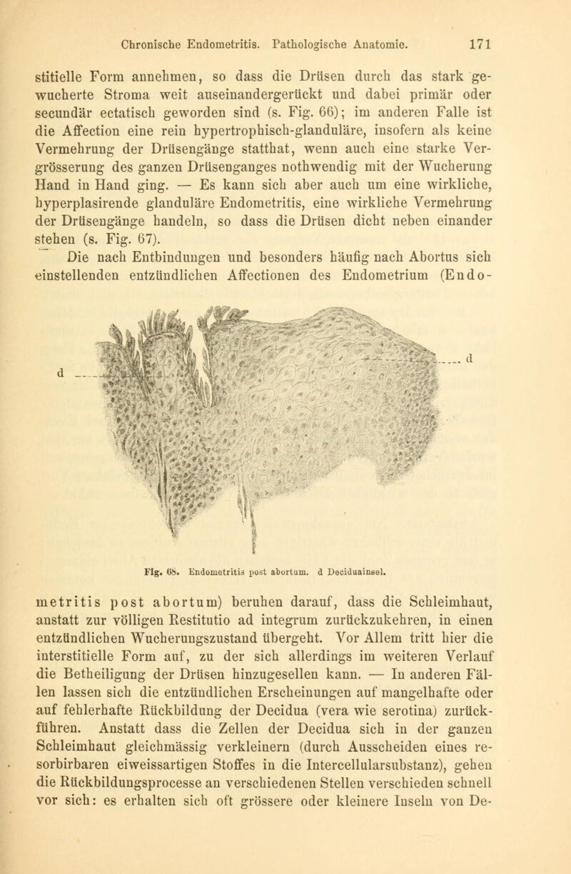 stitielle Form annehmen, so dass die Drüsen durch das stark ge- wucherte Stroma weit auseinandergerückt und dabei primär oder secundär ectatisch geworden sind (s. Fig. 66); im anderen Falle ist die Affection eine rein hypertrophisch-glanduläre, insofern als keine Vermehrung der Drüsengänge statthat, wenn auch eine starke Ver- grösserung des ganzen Drüsenganges nothwendig mit der Wucherung Hand in Hand ging. — Es kann sich aber auch um eine wirkliche, hyperplasirende glanduläre Endometritis, eine wirkliche Vermehrung der Drüsengänge handeln, so dass die Drüsen dicht neben einander stehen (s. Fig. 67). Die nach Entbindungen und besonders häufig nach Abortus sich einstellenden entzündlichen Affectionen des Endometrium (Endo- :' %£.-.-. d d __ o Fig. 68. Endometritis post abortum. d Deciduainsel. metritis post abortum) beruhen darauf, dass die Schleimhaut, anstatt zur völligen Restitutio ad integrum zurückzukehren, in einen entzündlichen Wucherungszustand übergeht. Vor Allem tritt hier die interstitielle Form auf, zu der sich allerdings im weiteren Verlauf die Betheiligung der Drüsen hinzugesellen kann. — In anderen Fäl- len lassen sich die entzündlichen Erscheinungen auf mangelhafte oder auf fehlerhafte Rückbildung der Decidua (vera wie serotina) zurück- führen. Anstatt dass die Zellen der Decidua sich in der ganzen Schleimhaut gleichmässig verkleinern (durch Ausscheiden eines re- sorbirbaren eiweissartigen Stoffes in die Intercellularsubstanz), gehen die Rückbildungsprocesse an verschiedenen Stellen verschieden schnell vor sich: es erhalten sich oft grössere oder kleinere Inseln von De-