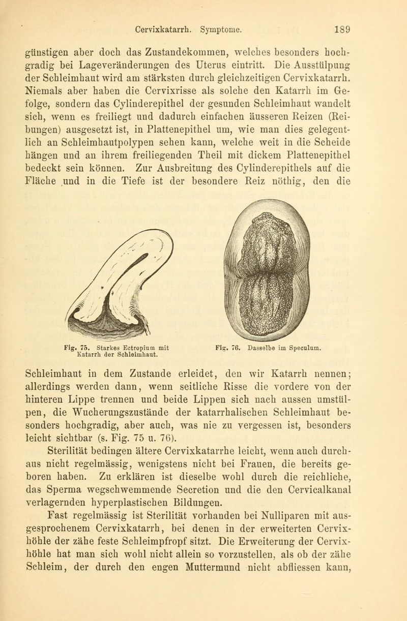 günstigen aber doch das Zustandekommen, welches besonders hoch- gradig bei Lageveränderungen des Uterus eintritt. Die Ausstülpung der Schleimhaut wird am stärksten durch gleichzeitigen Cervixkatarrh. Niemals aber haben die Cervixrisse als solche den Katarrh im Ge- folge, sondern das Cylinderepithel der gesunden Schleimhaut wandelt sich, wenn es freiliegt und dadurch einfachen äusseren Reizen (Rei- bungen) ausgesetzt ist, in Plattenepithel um, wie man dies gelegent- lich an Schleimhautpolypen sehen kann, welche weit in die Scheide hängen und an ihrem freiliegenden Theil mit dickem Plattenepithel bedeckt sein können. Zur Ausbreitung des Cylinderepithels auf die Fläche und in die Tiefe ist der besondere Reiz nöthig, den die Fig. 75. Starkes Ectropium mit Katarrh der Schleimhaut. Fis;. 76. Dasselbe im Speculum. Schleimhaut in dem Zustande erleidet, den wir Katarrh nennen; allerdings werden dann, wenn seitliche Risse die vordere von der hinteren Lippe trennen und beide Lippen sich nach aussen umstül- pen, die Wucherungszustände der katarrhalischen Schleimhaut be- sonders hochgradig, aber auch, was nie zu vergessen ist, besonders leicht sichtbar (s. Fig. 75 u. 76). Sterilität bedingen ältere Cervixkatarrhe leicht, wenn auch durch- aus nicht regelmässig, wenigstens nicht bei Frauen, die bereits ge- boren haben. Zu erklären ist dieselbe wohl durch die reichliche, das Sperma wegschwemmende Secretion und die den Cervicalkanal verlagernden hyperplastischen Bildungen. Fast regelmässig ist Sterilität vorhanden bei Nulliparen mit aus- gesprochenem Cervixkatarrh, bei denen in der erweiterten Cervix- höhle der zähe feste Schleimpfropf sitzt. Die Erweiterung der Cervix- höhle hat man sich wohl nicht allein so vorzustellen, als ob der zähe Schleim, der durch den engen Muttermund nicht abfliessen kann,