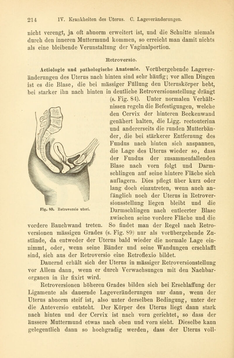 nicht verengt, ja oft abnorm erweitert ist, und die Schnitte niemals durch den inneren Muttermund kommen, so erreicht man damit nichts als eine bleibende Verunstaltung der Vaginalportion. Retroversio. Aetiolog-ie und pathologische Anatomie. Vorübergehende Lagever- änderuugen des Uterus nach hinten sind sehr häufig; vor allen Dingen ist es die Blase, die bei massiger Füllung den Uteruskörper hebt, bei starker ihn nach hinten in deutliche Retroversionsstellung drängt (s. Fig. 84). Unter normalen Verhält- nissen regeln die Befestigungen, welche den Cervix der hinteren Beckenwand genähert halten, die Ligg. rectouterina und andererseits die runden Mutterbän- der, die bei stärkerer Entfernung des Fundus nach hinten sich anspannen, die Lage des Uterus wieder so, dass der Fundus der zusammenfallenden Blase nach vorn folgt und Darm- schlingen auf seine hintere Fläche sich auflagern. Dies pflegt über kurz oder lang doch einzutreten, wenn auch an- fänglich noch der Uterus in Retrover- sionsstellung liegen bleibt und die Darmschlingen nach entleerter Blase zwischen seine vordere Fläche und die vordere Bauchwand treten. So findet man der Regel nach Retro- versionen massigen Grades (s. Fig. 89) nur als vorübergehende Zu- stände, da entweder der Uterus bald wieder die normale Lage ein- nimmt, oder, wenn seine Bänder und seine Wandungen erschlafft sind, sich aus der Retroversio eine Retroflexio bildet. Dauernd erhält sich der Uterus in massiger Retroversionstellung vor Allem dann, wenn er durch Verwachsungen mit den Nachbar- organen in ihr fixirt wird. Retroversionen höheren Grades bilden sich bei Erschlaffung der Ligamente als dauernde Lageveränderungen nur dann, wenn der Uterus abnorm steif ist, also unter derselben Bedingung, unter der die Anteversio entsteht. Der Körper des Uterus liegt dann stark nach hinten und der Cervix ist nach vorn gerichtet, so dass der äussere Muttermund etwas nach oben und vorn sieht. Dieselbe kann gelegentlich dann so hochgradig werden, dass der Uterus voll-