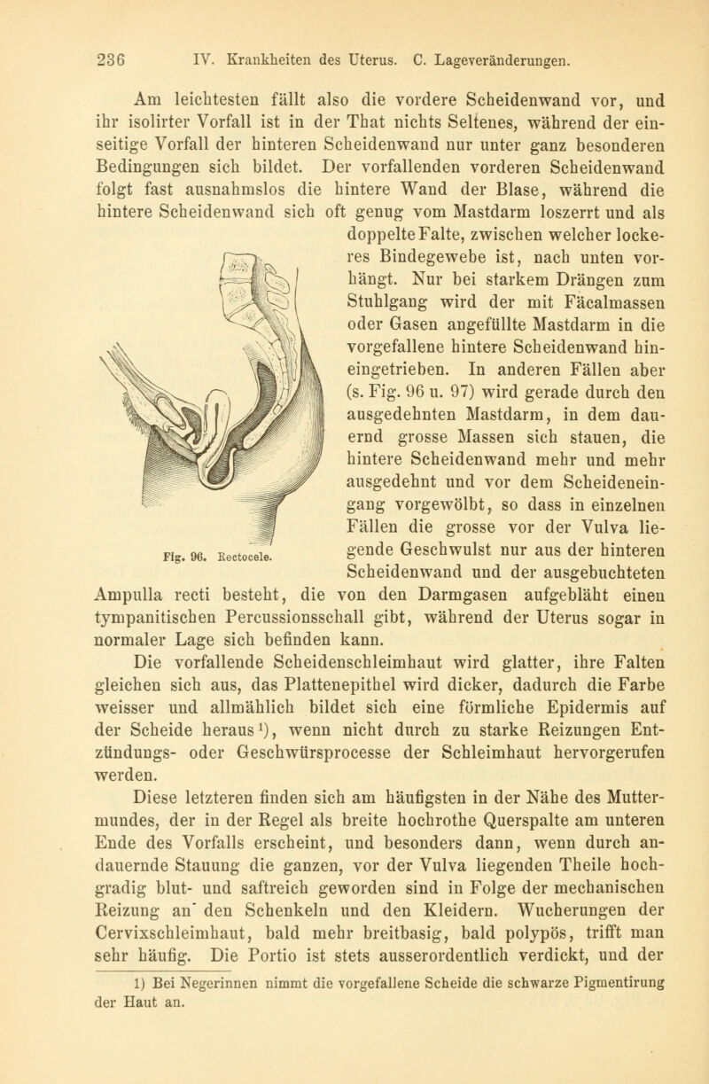 Am leichtesten fällt also die vordere Scheidenwand vor, und ihr isolirter Vorfall ist in der That nichts Seltenes, während der ein- seitige Vorfall der hinteren Scheidenwand nur unter ganz besonderen Bedingungen sich bildet. Der vorfallenden vorderen Scheidenwand folgt fast ausnahmslos die hintere Wand der Blase, während die hintere Scheidenwand sich oft genug vom Mastdarm loszerrt und als doppelte Falte, zwischen welcher locke- res Bindegewebe ist, nach unten vor- hängt. Nur bei starkem Drängen zum Stuhlgang wird der mit Fäcalmassen oder Gasen angefüllte Mastdarm in die vorgefallene hintere Scheidenwand hin- eingetrieben. In anderen Fällen aber (s. Fig. 96 u. 97) wird gerade durch den ausgedehnten Mastdarm, in dem dau- ernd grosse Massen sich stauen, die hintere Scheidenwand mehr und mehr ausgedehnt und vor dem Scheidenein- gang vorgewölbt, so dass in einzelnen Fällen die grosse vor der Vulva lie- gende Geschwulst nur aus der hinteren Scheidenwand und der ausgebuchteten Ampulla recti besteht, die von den Darmgasen aufgebläht einen tympanitischen Percussionsschall gibt, während der Uterus sogar in normaler Lage sich befinden kann. Die vorfallende Scheidenschleimhaut wird glatter, ihre Falten gleichen sich aus, das Plattenepithel wird dicker, dadurch die Farbe weisser und allmählich bildet sich eine förmliche Epidermis auf der Scheide heraus1), wenn nicht durch zu starke Reizungen Ent- zündungs- oder Geschwürsprocesse der Schleimhaut hervorgerufen werden. Diese letzteren finden sich am häufigsten in der Nähe des Mutter- mundes, der in der Regel als breite hochrothe Querspalte am unteren Ende des Vorfalls erscheint, und besonders dann, wenn durch an- dauernde Stauung die ganzen, vor der Vulva liegenden Theile hoch- gradig blut- und saftreich geworden sind in Folge der mechanischen Reizung an den Schenkeln und den Kleidern. Wucherungen der Cervixschleimhaut, bald mehr breitbasig, bald polypös, trifft man sehr häufig. Die Portio ist stets ausserordentlich verdickt, und der 1) Bei Negerinnen nimmt die vorgefallene Scheide die schwarze Pigmentirung der Haut an. Fig. 96. Kectocele.