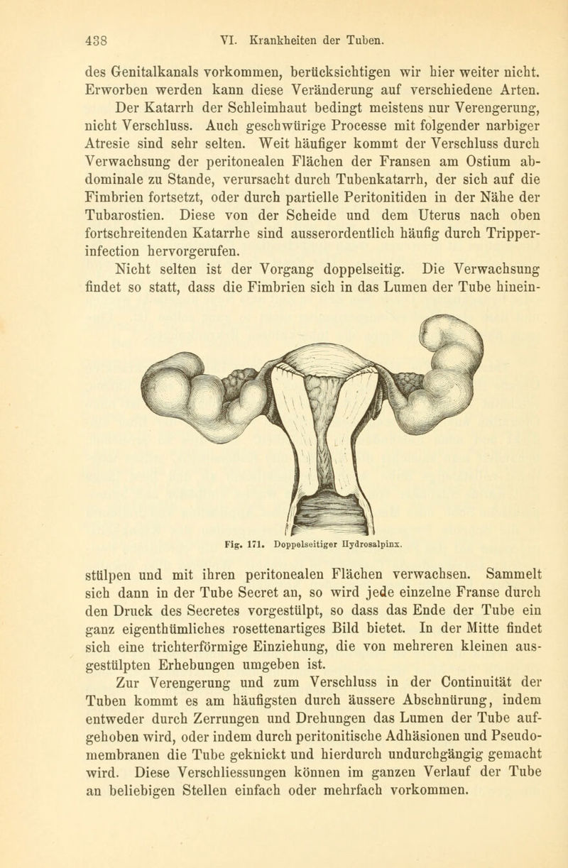 des Genitalkanals vorkommen, berücksichtigen wir hier weiter nicht. Erworben werden kann diese Veränderung auf verschiedene Arten. Der Katarrh der Schleimhaut bedingt meistens nur Verengerung, nicht Verschluss. Auch geschwürige Processe mit folgender narbiger Atresie sind sehr selten. Weit häufiger kommt der Verschluss durch Verwachsung der peritonealen Flächen der Fransen am Ostium ab- dominale zu Stande, verursacht durch Tubenkatarrh, der sich auf die Fimbrien fortsetzt, oder durch partielle Peritonitiden in der Nähe der Tubarostien. Diese von der Scheide und dem Uterus nach oben fortschreitenden Katarrhe sind ausserordentlich häufig durch Tripper- infection hervorgerufen. Nicht selten ist der Vorgang doppelseitig. Die Verwachsung findet so statt, dass die Fimbrien sich in das Lumen der Tube hinein- Fig. 171. Doppelseitiger Hydrosalpinx. stülpen und mit ihren peritonealen Flächen verwachsen. Sammelt sich dann in der Tube Secret an, so wird jede einzelne Franse durch den Druck des Secretes vorgestülpt, so dass das Ende der Tube ein ganz eigenthümliches rosettenartiges Bild bietet. In der Mitte findet sich eine trichterförmige Einziehung, die von mehreren kleinen aus- gestülpten Erhebungen umgeben ist. Zur Verengerung und zum Verschluss in der Continuität der Tuben kommt es am häufigsten durch äussere Abschnürung, indem entweder durch Zerrungen und Drehungen das Lumen der Tube auf- gehoben wird, oder indem durch peritonitische Adhäsionen und Pseudo- membranen die Tube geknickt und hierdurch undurchgängig gemacht wird. Diese Verschliessungen können im ganzen Verlauf der Tube an beliebigen Stellen einfach oder mehrfach vorkommen.