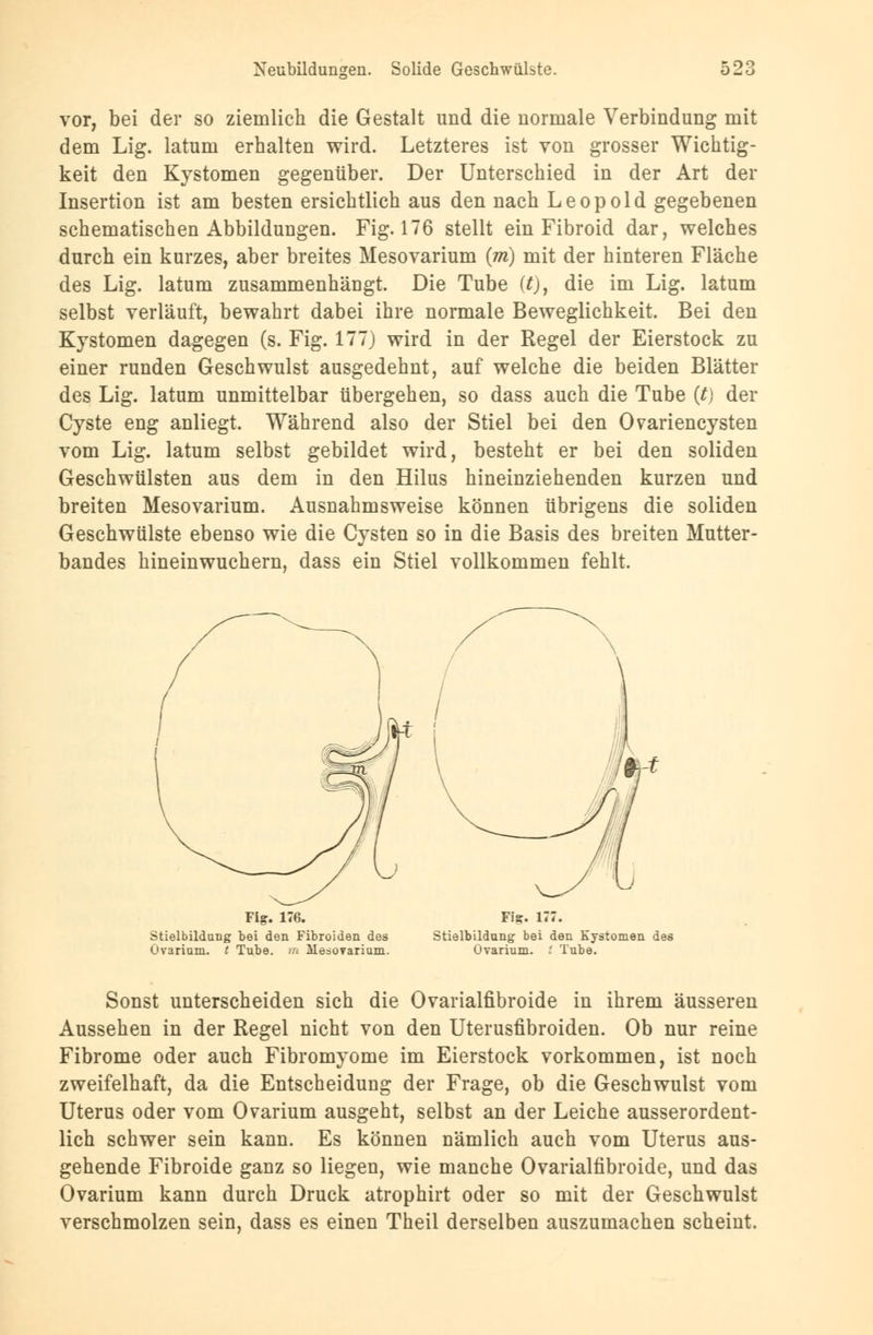 vor, bei der so ziemlich die Gestalt und die normale Verbindung mit dem Lig. latum erhalten wird. Letzteres ist von grosser Wichtig- keit den Kystomen gegenüber. Der Unterschied in der Art der Insertion ist am besten ersichtlich aus den nach Leopold gegebenen schematischen Abbildungen. Fig. 176 stellt ein Fibroid dar, welches durch ein kurzes, aber breites Mesovarium (m) mit der hinteren Fläche des Lig. latum zusammenhängt. Die Tube (Q, die im Lig. latum selbst verläuft, bewahrt dabei ihre normale Beweglichkeit. Bei den Kystomen dagegen (s. Fig. 177) wird in der Regel der Eierstock zu einer runden Geschwulst ausgedehnt, auf welche die beiden Blätter des Lig. latum unmittelbar übergehen, so dass auch die Tube (t) der Cyste eng anliegt. Während also der Stiel bei den Ovariencysten vom Lig. latum selbst gebildet wird, besteht er bei den soliden Geschwülsten aus dem in den Hilus hineinziehenden kurzen und breiten Mesovarium. Ausnahmsweise können übrigens die soliden Geschwülste ebenso wie die Cysten so in die Basis des breiten Mutter- bandes hineinwuchern, dass ein Stiel vollkommen fehlt. Stielbildung bei den Fibroiden des Ovariam. t Tube, m Meboyariam. Stielbildung bei den Kystomen des Ovarium. i Tube. Sonst unterscheiden sich die Ovarialfibroide in ihrem äusseren Aussehen in der Regel nicht von den Uterusfibroiden. Ob nur reine Fibrome oder auch Fibromyome im Eierstock vorkommen, ist noch zweifelhaft, da die Entscheidung der Frage, ob die Geschwulst vom Uterus oder vom Ovarium ausgeht, selbst an der Leiche ausserordent- lich schwer sein kann. Es können nämlich auch vom Uterus aus- gehende Fibroide ganz so liegen, wie manche Ovarialfibroide, und das Ovarium kann durch Druck atrophirt oder so mit der Geschwulst verschmolzen sein, dass es einen Theil derselben auszumachen scheint.