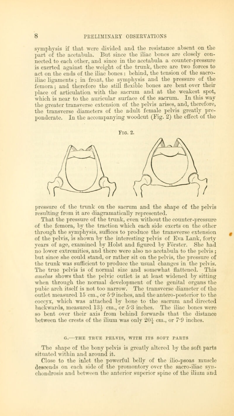 Symphysis if that were divided and the resistance absent on the pari of Che acetabula. Bui Bince the iliac bones are closely con- nected to each other, and Bince in the acetabula a counter-pressure is exerted against the weight of the trunk, there are two forces to act on the ends of the iliac bones : behind, the tension of the sacro- iliac ligaments; in front, the symphysis and the pressure of the femora; and therefore the still flexible bones are bent over their place of articulation with the sacrum and at the weakest spot, which is near to the auricular surface of the sacrum. In this way the greater transverse extension of the pelvis arises, and, therefore, the transverse diameters of the adult female pelvis greatly pre- ponderate. In the accompanying woodcut (Fig. 2) the effect of the Fig. 2. pressure of the trunk on the sacrum and the shape of the pelvis resulting from it are diagramatically represented. That the pressure of the trunk, even without the counter-pressure of the femora, by the traction which each side exerts on the other through the symphysis, suffices to produce the transverse extension of the pelvis, is shown by the interesting pelvis of Eva Lank, forty years of age, examined by Hoist and figured by Förster. She had no lower extremities, and there were also no acetabula to the pelvis ; but since she could stand, or rather sit on the pelvis, the pressure of the trunk was sufficient to produce the usual changes in the pelvis. The true pelvis is of normal size and somewhat flattened. This amelus shows that the pelvic outlet is at least widened by Bitting when through the normal development of the genital organs the pubic arch itself is not too narrow. The transverse diameter of the outlet measured 15 cm., or 5*9 indies, and the antero-posterior to 1 he coccyx, which was attached by bone to the sacrum and directed backwards, measured 13j cm., or 5*3 inches. The iliac hen es were so bent over their axis from behind forwards thai the distance between the crests of the ilium was only 2QJ cm., or 7'9 inches. G. THE TRUE PELVIS, WITH ITS SOFT TARTS The Bhape of the bony pelvis is greatly altered by the soft parts situated within and around it. Close to the inlel the powerful belly of the ilio-psoas muscle descends on each side of the promontory over the sacro-iliac syn- chondrosis and between the anterior superior spine of the ilium and