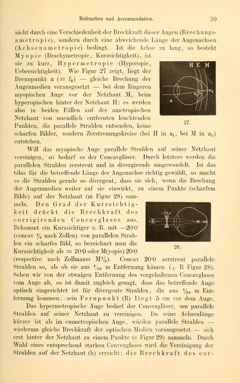 27. nicht durch eine Verschiedenheit der Brechkraft dieser Augen (Brechungs- am etropie), sondern durch eine abweichende Länge der Augenachsen (A c h s e n a m etropie) bedingt. Ist die Achse zu lang, so bestellt Myopie (Brachymetropie, Kurzsichtigkeit), ist sie zu kurz, Hypermetropie (Hyperopie, Uebersichtigkeit). Wie Figur 27 zeigt, liegt der Brennpunkt oc (= f2) — gleiche Brechung der Augenmedien vorausgesetzt — bei dem längeren myopischen Auge vor der Netzhaut M, beim hyperopischen hinter der Netzhaut H: es werden also in beiden Fällen auf der ametropischen Netzhaut von unendlich entfernten leuchtenden Punkten, die parallele Strahlen entsenden, keine scharfen Bilder, sondern Zerstreuungskreise (bei H in al5 bei M in a2) entstehen. Will das myopische Auge parallele Strahlen auf seiner Netzhaut vereinigen, so bedarf es der Concavgläser. Durch letztere werden die parallelen Strahlen zerstreut und in divergirencle umgewandelt. Ist das Glas für die betreffende Länge der Augenachse richtig gewählt, so macht es die Strahlen gerade so divergent, dass sie sich, wenn die Brechung der Augenmedien weiter auf sie einwirkt, zu einem Punkte (scharfem Bilde) auf der Netzhaut (m Figur 28) sam- meln. Den Grad der Kurzsichtig- keit drückt die B re c h k r a f t des cor rigir enden Concavglases aus. Bekommt ein Kurzsichtiger z. B. mit —20-0 (concav l/2 nach Zollen) von parallelen Strah- len ein scharfes Bild, so bezeichnet man die Kurzsichtigkeit als = 2O0 oder M(yopie) 20*0 (respective nach Zollmaass MV2). Concav 20*0 zerstreut parallele Strahlen so, als ob sie aus %0 m Entfernung kämen (-f- R Figur 28). Sehen wir von der etwaigen Entfernung des vorgehaltenen Concavglases vom Auge ab, so ist damit zugleich gesagt, dass das betreffende Auge optisch eingerichtet ist für divergente Strahlen, die aus y20 m Ent- fernung kommen: - sein F e r np unkt (R) liegt 5 cm vor dem Auge. Das hypermetropische Auge bedarf der Convexgläser, um parallele Strahlen auf seiner Netzhaut zu vereinigen. Da seine Achsenlänge kürzer ist als im emmetropischen Auge, würden parallele Strahlen — wiederum gleiche Brechkraft der optischen Medien vorausgesetzt — sich erst hinter der Netzhaut zu einem Punkte (e Figur 29) sammeln. Durch Wahl eines entsprechend starken Convexglases wird die Vereinigung der Strahlen auf der Netzhaut (h) erreicht: die Brechkraft des cor-