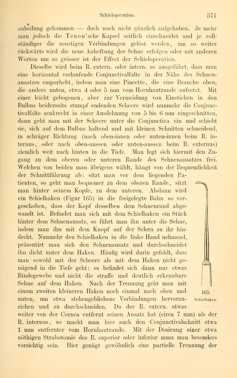 • anheihmg gekommen — doch noch nicht gänzlich aufgehoben. Je mehr man jedoch die Tenon'sche Kapsel seitlich einschneidet und je voll- ständiger die sonstigen Verbindungen gelöst werden, um so weiter rückwärts wird die neue Anheftung der Sehne erfolgen oder mit anderen Worten um so grösser ist der Effect der Schieloperation. Dieselbe wird beim R. extern, oder intern, so ausgeführt, dass man eine horizontal verlaufende Conjunctivalfalte in der Nähe des Sehnen- ansatzes emporhebt, indem man eine Pincette, die eine Branche oben, die andere unten, etwa 4 oder 5 mm vom Hornhautrande aufsetzt. Mit einer leicht gebogenen, aber zur Vermeidung von Einstichen in den Bulbus beiderseits stumpf endenden Scheere wird nunmehr die Conjunc- tivalfalte senkrecht in einer Ausdehnung von 5 bis 6 mm eingeschnitten, dann geht man mit der Scheere unter die Conjunctiva ein und schiebt sie, sich auf dem Bulbus haltend und mit kleinen Schnitten schneidend, in schräger Richtung (nach oben-innen oder unten-innen beim R. in- ternus, oder nach oben-aussen oder unten-aussen beim R. externus) ziemlich weit nach hinten in die Tiefe. Man legt sich hiermit den Zu- gang zu dem oberen oder unteren Rande des Sehnenansatzes frei. Welchen von beiden man übrigens wählt, hängt von der Bequemlichkeit der Schnittführung ab: sitzt man vor dem liegenden Pa- tienten, so geht man bequemer zu dem oberen Rande, sitzt e=5^ man hinter seinem Kopfe, zu dem unteren. Alsdann wird ein Schielhaken (Figur 165) in die freigelegte Bahn so vor- geschoben, dass der Kopf desselben dem Sehnenrand abge- wandt ist. Befindet man sich mit dem Schielhaken ein Stück hinter dem Sehnenansatz, so führt man ihn unter die Sehne, indem man ihn mit dem Knopf auf der Sclera zu ihr hin- dreht. Nunmehr den Schielhaken in die linke Hand nehmend, präsentirt man sich den Sehnenansatz und durchschneidet ihn dicht unter dem Haken. Häufig wird darin gefehlt, dass man sowohl mit der Scheere als mit dem Haken nicht ge- nügend in die Tiefe geht: es befindet sich dann nur etwas Bindegewebe und nicht die straffe und deutlich erkennbare Sehne auf dem Haken. Nach der Trennung geht man mit einem zweiten kleineren Haken noch einmal nach oben und ißö. unten, um etwa stehengebliebene Verbindungen hervorzu- scbieihaken. ziehen und zu durchschneiden. Da der R. extern, etwas weiter von der Cornea entfernt seinen Ansatz hat (circa 7 mm) als der R. internus, so macht man hier auch den Conjunctivalschnitt etwa 1 mm entfernter vom Hornhautrande. Mit der Dosirung einer etwa nöthigen Strabotomie des R. superior oder inferior muss man besonders vorsichtig sein. Hier genügt gewöhnlich eine partielle Trennung der