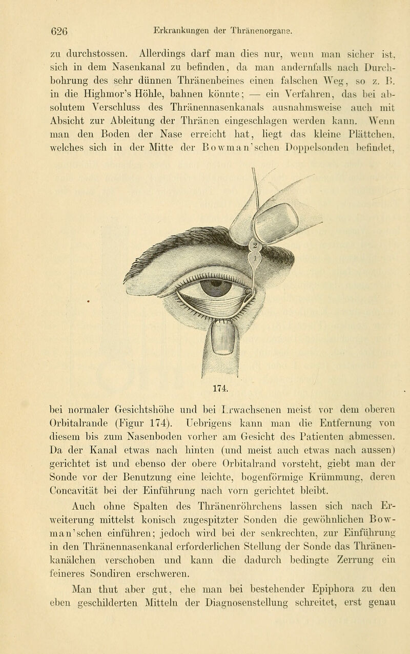 zu durchstossen. Allerdings darf man dies nur, wenn man sicher ist, sich in dem Nasenkanal zu befinden, da man andernfalls nach Durch- bohrung des sehr dünnen Thränenbeines einen falschen Weg, so z. B. in die Highmor's Höhle, bahnen könnte; — ein Verfahren, das bei ab- solutem Verschluss des Thränennasenkanals ausnahmsweise auch mit Absicht zur Ableitung der Thränen eingeschlagen werden kann. Wenn man den Boden der Nase erreicht hat, liegt das kleine Plättchen, welches sich in der Mitte der Bowman'sehen Doppelsonden befindet, 174. bei normaler Gesichtshöhe und bei Lrwachsenen meist vor dem oberen Orbitalrande (Figur 174). Uebrigens kann man die Entfernung von diesem bis zum Nasenboden vorher am Gesicht des Patienten abmessen. Da der Kanal etwas nach hinten (und meist auch etwas nach aussen) gerichtet ist und ebenso der obere Orbitalrand vorsteht, giebt man der Sonde vor der Benutzung eine leichte, bogenförmige Krümmung, deren Concavität bei der Einführung nach vorn gerichtet bleibt. Auch ohne Spalten des Thränenröhrchens lassen sich nach Er- weiterung mittelst konisch zugespitzter Sonden die gewöhnlichen Bow- man'sehen einführen; jedoch Avird bei der senkrechten, zur Einführung in den Thränennasenkanal erforderlichen Stellung der Sonde das Thränen- kanälchen verschoben und kann die dadurch bedingte Zerrung ein feineres Sondiren erschweren. Man thut aber gut, ehe man bei bestehender Epiphora zu den eben geschilderten Mitteln der Diagnosenstellung schreitet, erst genau