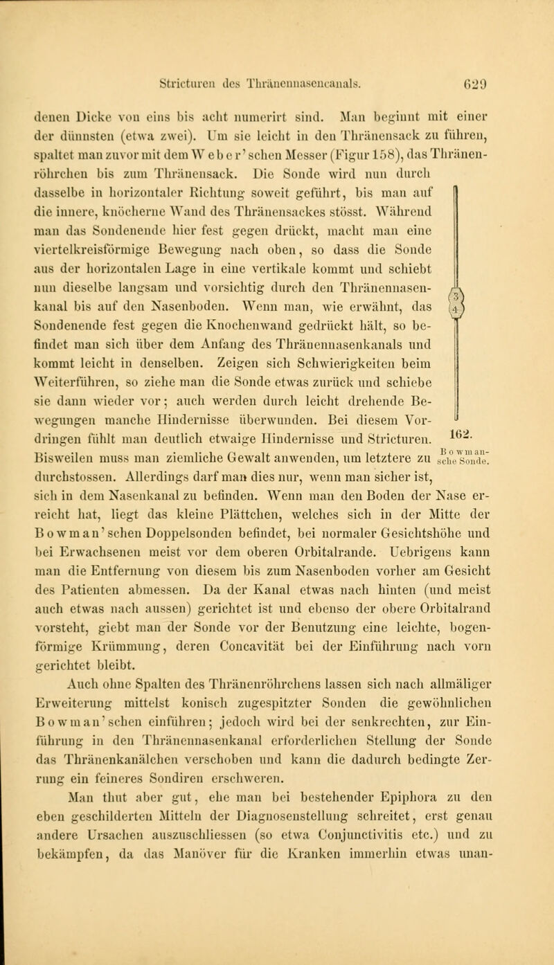 deneo Dicke von eins bis acht numerirf sind. Man beginnt mit einer der dünnsten (etwa zwei). Um sie leicht in den Thränensack zu führen, spaltet man zuvor mit dem Webe r' sehen Messer (Figur 158), das Thränen- röhrchen bis zum Thränensack. Die Sonde wird nun durch dasselbe in horizontaler Richtung soweit geführt, bis man auf die innere, knöcherne Wand des Thränensackes stösst. Während man das Sondenende hier fest gegen drückt, macht man eine viertelkreisförmige Bewegung nach oben, so dass die Sonde aus der horizontalen Lage in eine vertikale kommt und schiebt nun dieselbe langsam und vorsichtig durch den Thränennasen- kanal bis auf den Nasenboden. Wenn man, wie erwähnt, das Sondenende fest gegen die Knochenwand gedrückt hält, so be- findet man sich über dem Anfang des Thränennasenkanals und kommt leicht in denselben. Zeigen sich Schwierigkeiten beim Weiterführen, so ziehe man die Sonde etwas zurück und schiebe sie dann wieder vor; auch werden durch leicht drehende Be- wegungen manche Hindernisse überwunden. Bei diesem Vor- dringen fühlt man deutlich etwaige Hindernisse und Stricturen. *m Bisweilen muss man ziemliche Gewalt anwenden, um letztere zu scheSonde durchstossen. Allerdings darf man dies nur, wenn man sicher ist, sich in dem Nasenkanal zu befinden. Wenn man den Boden der Nase er- reicht hat, liegt das kleine Plättchen, welches sich in der Mitte der Bowman'sehen Doppelsonden befindet, bei normaler Gesichtshöhe und bei Erwachsenen meist vor dem oberen Orbitalrande. Uebrigens kann man die Entfernung von diesem bis zum Nasenboden vorher am Gesicht des Patienten abmessen. Da der Kanal etwas nach hinten (und meist auch etwas nach aussen) gerichtet ist und ebenso der obere Orbitalrand vorsteht, giebt man der Sonde vor der Benutzung eine leichte, bogen- förmige Krümmung, deren Concavität bei der Einführung nach vorn gerichtet bleibt. Auch ohne Spalten des Thränenröhrchens lassen sich nach allmäliger Erweiterung mittelst konisch zugespitzter Sonden die gewöhnlichen Bowman' sehen einführen; jedoch wird bei der senkrechten, zur Ein- führung in den Thräncnnasenkanal erforderlichen Stellung der Sonde das Thränenkanälchen verschoben und kann die dadurch bedingte Zer- rung ein feineres Sondiren erschweren. Man thut aber gut, ehe man bei bestehender Epiphora zu den eben geschilderten Mitteln der Diagnosenstellung schreitet, erst genau andere Ursachen auszuschliessen (so etwa Conjunctivitis etc.) und zu bekämpfen, da das Manöver für die Kranken immerhin etwas unan-