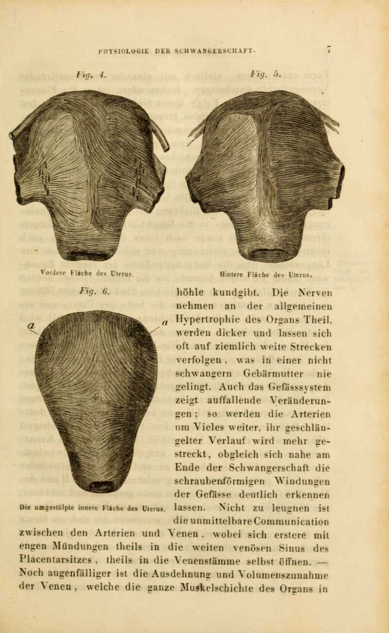 /•'/;/. 4. Fig. ö. Vordere Hache des Dlrras. Hintere Fläche des Uterus. &9* 0. höhle kundgibt. Die Nerven nehmen an der allgemeinen Hypertrophie des Organs Theil. werden dicker und lassen sich oft auf ziemlich weite Strecken verfolgen . was in einer nicht schwängern Gebärmutter nie gelingt. Auch das Gefässsystem zeigt auffallende Veränderun- gen : so werden die Arterien um Vieles weiter, ihr geschlän- gelter Verlauf wird mehr ge- streckt, obgleich sich nahe am Ende der Schwangerschaft die schraubenförmigen Windungen der Gefaase deutlich erkennen hassen. Nicht tu leugnen ist die unmittelbare Communication zwischen den Arterien und Venen, wobei sich erster* mit engen Mündungen theils in die weiten venösen Sinus des Placentarsitzes , theils in die Venenstämme selbst öffnen. Noch augenfälliger ist die Ausdehnung und Volumenszunahme der Vetiem, welche die ganze 3Iuske]>chichte des Organs in Die umgestülpte innere Fläche des Uterus.