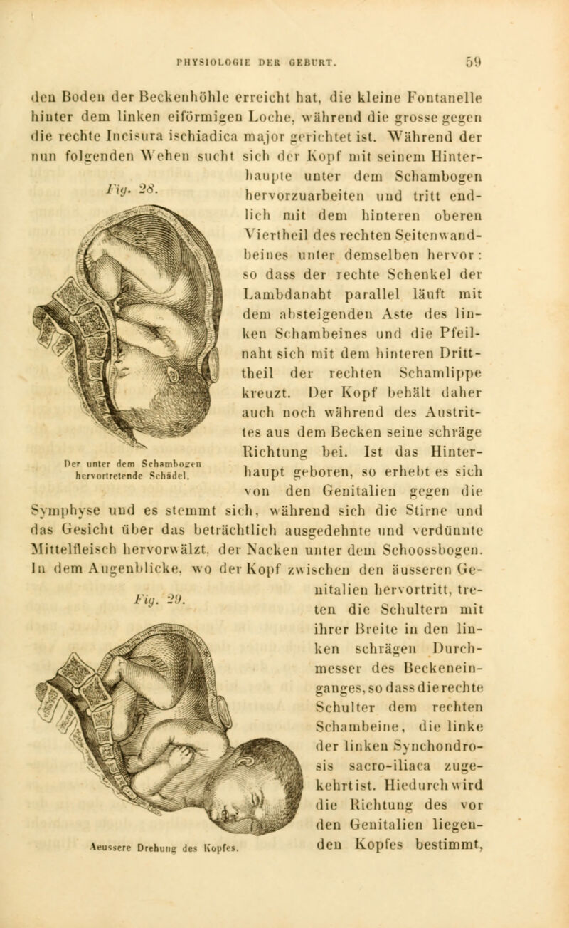 den Boden der Be< kenhöhle erreicht hat, die kleine Fontanelle1 hinter dem linken eiförmigen Loche, «rührend die grosse gegen die rechte Incisüra ischiadica major gerichtet ist. Während der nun folgenden Wehen sucht sich der Kopf mit seinem Hinter- haupte unter dem Schambogen hervorzuarbeiten und tritt end- lich mit dem hinteren oberen Viertheil des rechten Seiten* and- beines unter demselben hervor: so dass der rechte Schenkel der Lambdanaht parallel läuft mit dem absteigenden Aste des lin- ken Schambeines und die Pfeil- naht sich mit dem hinteren Dritt - theil der rechten Schamlippe kreuzt. Der Kopf behält daher auch noch während des Austrit- tes aus dem Becken seine schräge Richtung bei. Ist das Hinter- haupt geboren, so erhebt es sich von den Genitalien gegen die Symphyse und es stemmt sich, während sich die Stirne und das Gesicht über das beträchtlich ausgedehnte und verdünnte Mittelfleisch hervorwälzt, der Nacken unter dem Schoossbogen. In dem Augenblicke, wo der Kopf zwischen ^i^n äusseren Ge- nitalien hervortritt, tre- ten die Schultern mit ihrer Breite in den lin- ken schrägen Durch- messer des Beckenein- gauge-.M) dassdierechte Schulter dem rechten Schambeine, die linke der linken S) nchondro- i Bis sacro-iliara zuge- kehrt i>t. Hiedurch wird die Richtung des vor den Genitalien liegen- Aeussere Drehm.e des Kopfes. den Kopfes bestimmt, Per unter Hern Schamboeen hervortretende Schädel.
