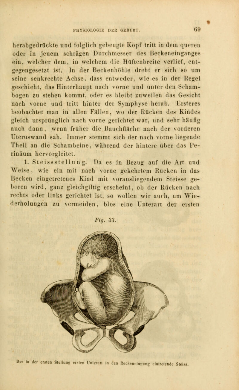 herabgedrückte und folglich gebeugte Kopf tritt in dem queren oder in jenem schrägen Durchmesser (\i>* Heckeneinganges ein, welcher dem, in welchem die Hüftenbreite verlief, ent- gegengesetzt ist. In der Beckenhühle dreht er sich so um seine senkrechte Achse, dass entweder, wie es in der Regel geschieht, das Hinterhaupt nach vorne und unter den Scham- bogen zu stehen kommt, oder es bleibt zuweilen das Gesicht nach vorne und tritt hinter der Symphyse herab. Ersteres beobachtet man in allen Fällen, wo der Rücken des Kindes gleich ursprünglich nach vorne gerichtet war, und sehr häufig auch dann, wenn früher die Bauchfläche nach der vorderen Uteruswand sah. Immer stemmt sich der nach vorne liegende Theil an die Schambeine, während der hintere über das Pe- rinäum hervorgleitet. 1. SteissStellung. Da es in Bezug auf die Art und Weise , wie ein mit nach vorne gekehrtem Rücken in das Becken eingetretenes Kind mit vorausliegendem Steisse ge- boren wird, ganz gleichgiltig erscheint, ob der Rücken nach rechts oder links gerichtet ist, so wollen wir auch, um Wie- derholungen zu vermeiden, blos eine Unterart der ersten Fig. 33. Der tu der ersten Stellung ersten Unterer! in -Jen Beckentinsrnng eintretende gleite.