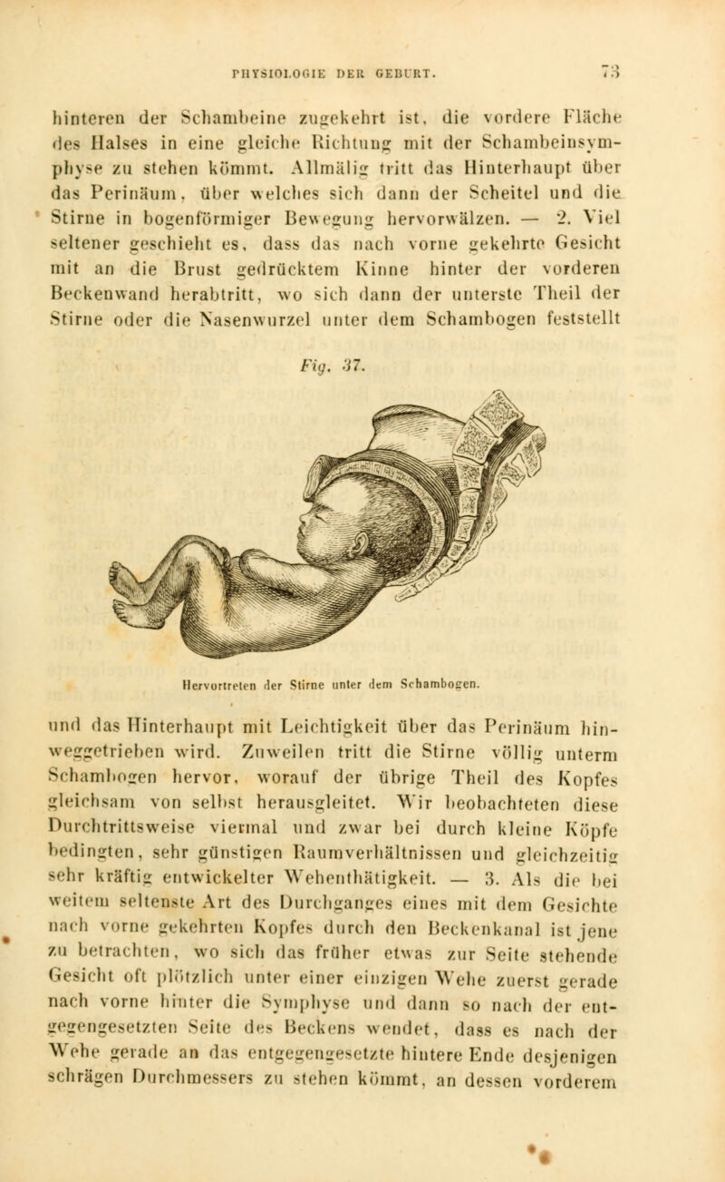 hinteren der Schambeine zugekehrt ist, die vordere Fläche des Halses in eine gleiche Richtung mit der Schambeinsym- pbyse ZU stehen kömmt. Allmalig tritt das Hinterhaupt ober das Perinäum. über welches sich dann der Scheitel und die Stirne in bogenförmiger Bewegung hervorwälzen. — 2. Viel seltener geschieht es, dass das nach vorne gekehrte Gesicht mit an die Brust gedrücktem Kinne hinter der vorderen Beckenwand herabtritt, wo sich dann der unterste Theil der Stirne oder die Nasenwurzel unter dem Schambogen feststellt Fig. 3Z. Hervortreten der Stirne unter dem Schambojren. und das Hinterhaupt mit Leichtigkeit über das Perinäum hiri- weggetriebei) wird. Zuweilen tritt die Stirne völlig unterm Schambogen hervor, worauf der übrige Theil des Kopfes gleichsam von selbst herausgleitet. Wir beobachteten diese Durchtrittsweise viermal und zwar bei durch kleine Köpfe bedingten, sehr günstigen Paum\ erhältnissen und gleichzeitig sehr kräftig entwickelter Wehenthätigkeit. — 3. Als die bei weitem seltenste Art des Durchganges eines mit dem Gesichte nach vorne gekehrten Kopfe- durch den Beckenkaoal ist jene zu betrachten, wo sich das froher etwas zur Seite stehende Gesicht oft plötzlich unter einer einzigen Wehe zuerst gerade nach vorne hinter die Symphyse und dann so nach der ent- gegengesetzten Seite des Beckens wendet, dass es nach der Wehe gerade an das entgegengesetzte hintere Ende desjenigen schrägen Durchmessers zu Btehen kömmt, an dessen vorderem ♦•