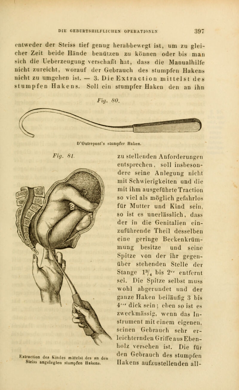 entweder der Steiss tief genug herabbewegt ist, um zu glei- cher Zeit beide Hände benutzen zu können oder bis man sich die leberzeugung verschallt hat, das« die Manualhilfe nicht Kareicht, worauf der Gebrauch des stumpfen Hakens nicht zu umgehet) ist. — 3. Die Extract ion mittelst des stumpfen Hakens. Soll ein stumpfer Haken den an ihn Fig. 80. D'Outreponfs stumpfer Haken. Fig. 81. Kxtraetion des Kindes mittelst des an den Sleiss angelegten stumpfen Hakens. zu stellenden Anforderungen entsprechen, soll insbeson- dere seine Anlegung nicht mit Schwierigkeiten und die mit ihm ausgeführteTraction so viel als möglich gefahrlos für Mutter und Kind sein, so ist es unerlässlich, dass der in die Genitalien ein- zuführende Theil desselben eine geringe Beckenkrüm- mung besitze und seine Spitze von der ihr gegen- über stehenden Stelle der Stange l3/4 bis 2 entfernt sei. Die Spitze selbst muss wohl abgerundet und der ganze Haken beiläufig 3 bis 4' dick sein: eben SO ist es zweckmässig, wenn das In- strument mit einem eigenen, seinen Gebrauch sehr er- leichternden Griffe aus Eben- holz versehen ist. Die für den Gebrauch des stumpfen Ilakens aufzustellenden all-