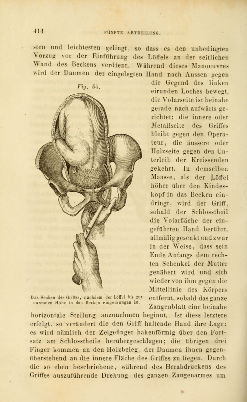 HINKTE ABTHEILING. sten und leichtesten gelingt, so dass es den unbedingten Vorzug vor der Einführung des Löffels an der seitliehen Wand des Beckens verdient. Während dieses Manoeuvres wird der Daumen der eingelegten Hand nach Aussen gegen die Gegend des linken eirunden Loches bewegt, die Volarseite ist beinahe gerade nacli aufwärts ge- richtet: die innere oder Metallseite des Griffes bleibt gegen den Opera- teur, die äussere oder Holzseite gegen den Un- terleib der Kreissenden gekehrt. In demselben Maasse, als der Löffel höher über den Kindes- kopf in das Becken ein- dringt, wird der Griff. sobald der Schlosstheil die Volarfläche der ein- geführten Hand berührt, allmälig gesenkt und zwar in der Weise, dass sein Ende Anfangs dem rech- ten Schenkel der Mutter genähert wird und sich wieder von ihm gegen die Mittellinie des Körpers entfernt, sobald das ganze Zangenblatt eine beinahe horizontale Stellung anzunehmen beginnt. Ist diess letztere erfolgt, so verändert die den Griff haltende Hand ihre Lage: es wird nämlich der Zeigefinger hakenförmig über den Eort- satz am Schlosstheile herübergeschlagen: die übrigen drei Finger kommen an den Holzbeleg, der Daumen ihnen gegen- überstehend au die innere Fläche des Griffes zu liegen. Durch die so eben beschriebene, während des Herabdrückens des Griffes auszuführende Drehung des ganzen Zangenarmes um Das Senken des Griffes, nachdem der Löffel bis zur normalen Höhe in das Becken eingedrungen ist.