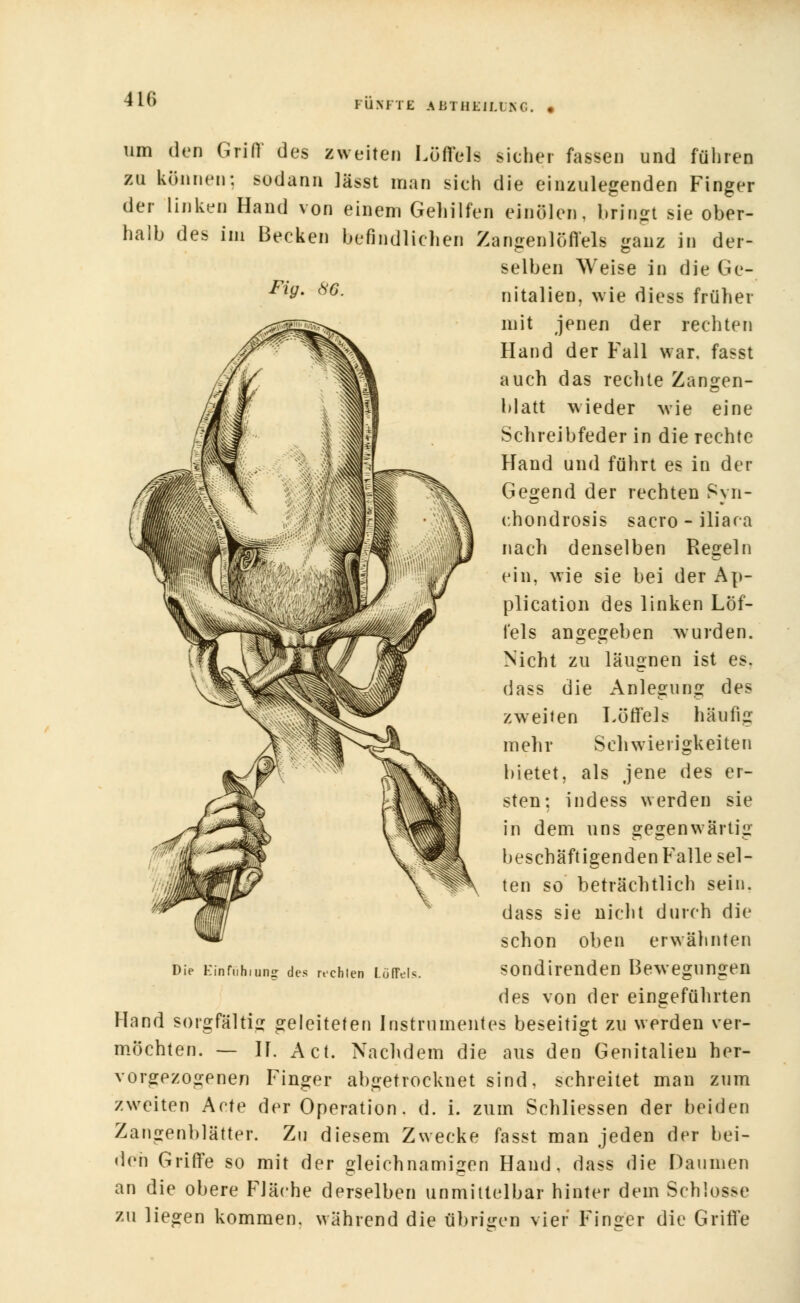 FÜNFTE ABTHEJLÜKG. • um den Griff des zweiten Löffels sicher fassen und führen zu können: sodann läset man sich die einzulegenden Finger der linken Hand von einem Gehilfen einölen, bringt sie ober- halb des im Becken befindlichen Zangen löffele ganz in der- selben Weise in die Ge- ™9' (i)'6- nitalien, wie diess früher mit jenen der rechten Hand der Fall war. fasst auch das rechte Zangen- blatt wieder wie eine Schreibfeder in die rechte Hand und führt es in der Gegend der rechten Syn- chondrosis sacro - iliaca nach denselben Regeln ein, wie sie bei der Ap- plication des linken Löf- fels angegeben wurden. Nicht zu läugnen ist es. dass die Anlegung des zweiten Löffels häufig mehr Schwierigkeiten bietet, als jene des er- sten: indess werden sie in dem uns gegenwärtig beschäftigenden Falle sel- ten so beträchtlich sein, dass sie nicht durch die schon oben erwähnten sondirenden Bewegungen des von der eingeführten Hand sorgfältig geleiteten Instrumentes beseitigt zu werden ver- möchten. — H. Act. Nachdem die aus den Genitalien her- vorgezogenen Finger abgetrocknet sind, schreitet man zum zweiten Acte der Operation. d. i. zum Schliessen der beiden Zangenblätter. Zu diesem Zwecke fasst man jeden der bei- den Griffe so mit der gleichnamigen Hand, dass die Daumen an die obere Fläche derselben unmittelbar hinter dem Schlosse zu liegen kommen, während die übrigen vier Finircr die Griffe Die Einfühlung des rechlen Löffels
