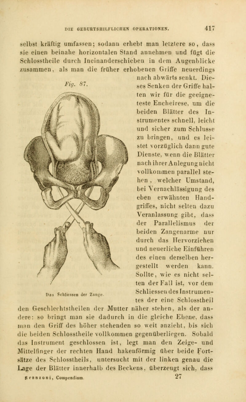 selbst kräftig umfassen; sodann erhebt man letztere so, dass sie einen beinahe horizontalen Stand annehmen und fügt die Schlosstheile durch Ineinanderschieben in dem Augenblicke zusammen, als man die früher erhobenen Griffe neuerdings nach abwärts senkt. Die- ses Senken der Griffe hal- ten wir für die geeigne- teste Encheirese, um die beiden Blätter des In- strumentes schnell, leicht und sicher zum Schlüsse zu bringen, und es lei- stet vorzüglich dann gute Dienste, wenn die Blätter nach ihrer Anlegung nicht vollkommen parallel ste- hen . welcher Umstand, bei Vernachlässigung des eben erwähnten Hand- griffes, nicht selten dazu Veranlassung gibt, dass der Parallelismus der beiden Zangenarme nur durch das Hervorziehen und neuerliche Einführen des einen derselben her- gestellt werden kann. Sollte. * ie es nicht >el- ten der Fall ist, vor dem Schliessen des Instrumen- tes der eine Schlosstheil den Geschlechtstheilen der Mutter näher stehen, als der an- dere: >o bringt man sie dadurch in die gleiche Ebene, das- man (\v\\ Griff des höher stehenden so weit anzieht, bis sich die beiden Schlosstheile vollkommen gegenüberliegen. Sobald das Instrument geschlossen ist, legt man den Zeige- und Mittelfinger der rechten Hand hakenförmig über beide Fort- sätze des Schlosstheils, untersucht mit der linken genau die I^age der Blätter innerhalb des Beckens, überzeugt sich, dase Scanzoni, Compendium. <-1 Da? Schliessen der Zange.