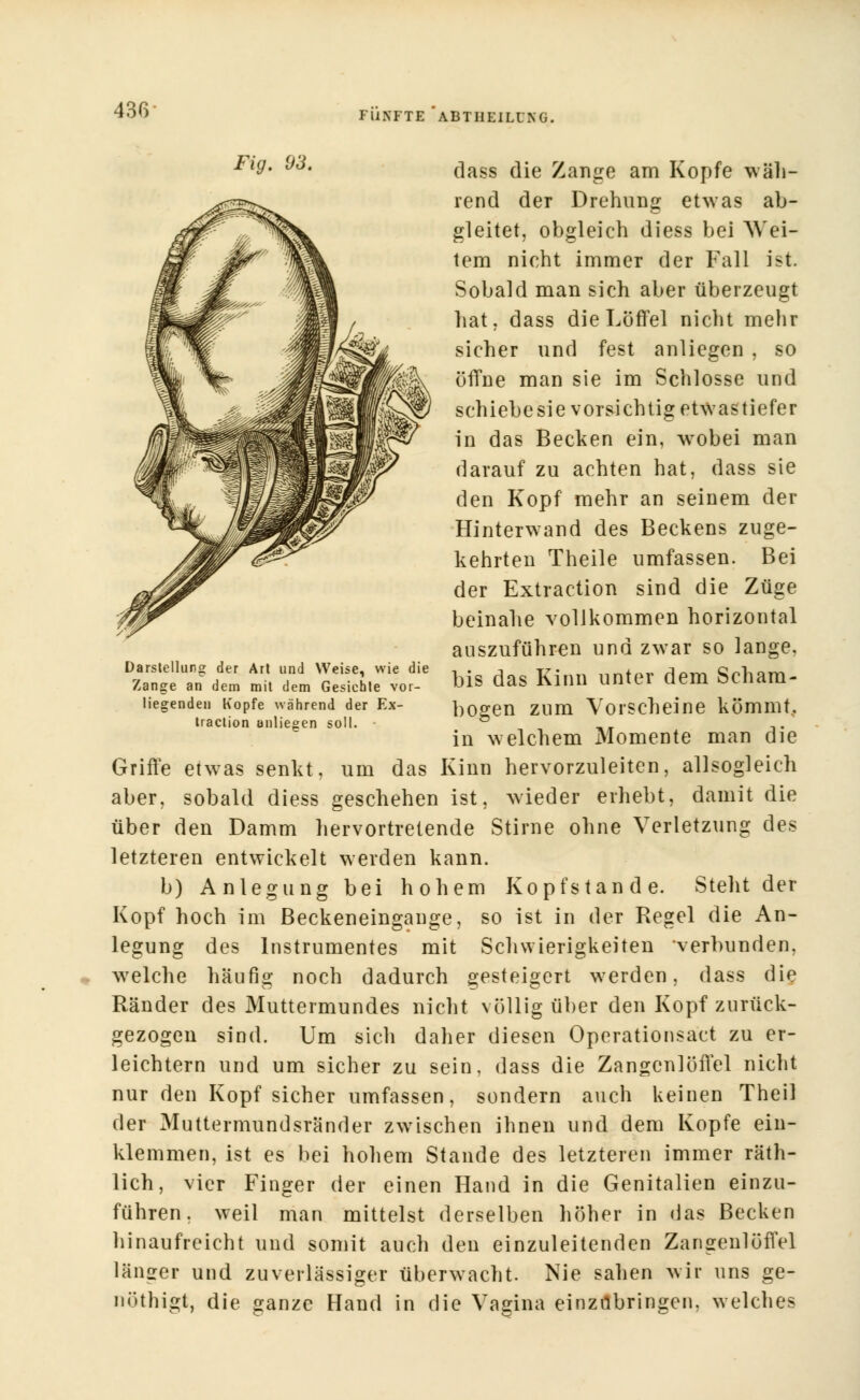 430 fünfte abtheilcng. FiV- 9&* dass die Zarige am Kopfe wäh- rend der Drehung etwas ab- gleitet, obgleich diess bei Wei- tem nicht immer der Fall ist. Sobald man sich aber überzeugt hat. dass die Löffel nicht mehr sicher und fest anliegen , so öffne man sie im Schlosse und schiebe sie vorsiehtig etwas tiefer in das Becken ein, wrobei man darauf zu achten hat, dass sie den Kopf mehr an seinem der Hinterwand des Beckens zuge- kehrten Theile umfassen. Bei der Extraction sind die Züge beinahe vollkommen horizontal auszuführen und zwar so lange, bis das Kinn unter dem Scham- bogen zum Vorscheine kömmt, in welchem Momente man die Griffe etwas senkt, um das Kinn hervorzuleiten, allsogleich aber, sobald diess geschehen ist, wieder erhebt, damit die über den Damm hervortretende Stirne ohne Verletzung des letzteren entwickelt werden kann. b) Anlegung bei hohem Kopfstande. Steht der Kopf hoch im Beckeneingange, so ist in der Regel die An- legung des Instrumentes mit Schwierigkeiten verbunden, welche häufig noch dadurch gesteigert werden, dass die Ränder des Muttermundes nicht völlig über den Kopf zurück- gezogen sind. Um sich daher diesen Operationsäet zu er- leichtern und um sicher zu sein, dass die Zangcnlöffel nicht nur den Kopf sicher umfassen, sondern auch keinen Theil der Muttermundsränder zwischen ihnen und dem Kopfe ein- klemmen, ist es bei hohem Stande des letzteren immer räth- lich, vier Finger der einen Hand in die Genitalien einzu- führen, weil man mittelst derselben höher in das Becken hinaufreicht und somit auch den einzuleitenden Zangenlöffel länget und zuverlässiger überwacht. Nie sahen wir uns ge- nöthigt, die ganze Hand in die Vagina einzubringen, welches Darstellung der Art und Weise, wie die Zange an dem mit dem Gesichte vor- liegenden Kopfe während der Ex- traction anliegen soll.
