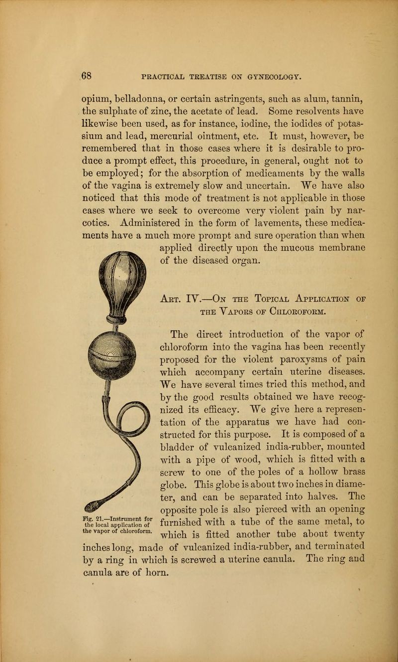 opium, belladonna, or certain astringents, such as alum, tannin, the sulphate of zinc, the acetate of lead. Some resolvents have likewise been used, as for instance, iodine, the iodides of potas- sium and lead, mercurial ointment, etc. It must, however, be remembered that in those cases where it is desirable to pro- duce a prompt effect, this procedure, in general, ought not to be employed ; for the absorption of medicaments by the walls of the vagina is extremely slow and uncertain. We have also noticed that this mode of treatment is not applicable in those cases where we seek to overcome very violent pain by nar- cotics. Administered in the form of lavements, these medica- ments have a much more prompt and sure operation than when applied directly upon the mucous membrane of the diseased organ. Art. IV.—On the Topical Application of the Vapors of Chloroform. The direct introduction of the vapor of chloroform into the vagina has been recently proposed for the violent paroxysms of pain which accompany certain uterine diseases. We have several times tried this method, and by the good results obtained we have recog- nized its efficacy. We give here a represen- tation of the apparatus we have had con- structed for this purpose. It is composed of a bladder of vulcanized india-rubber, mounted with a pipe of wood, which is fitted with a screw to one of the poles of a hollow brass globe. This globe is about two inches in diame- ter, and can be separated into halves. The opposite pole is also pierced with an opening furnished with a tube of the same metal, to which is fitted another tube about twenty inches long, made of vulcanized india-rubber, and terminated by a ring in which is screwed a uterine canula. The ring and canula are of horn. Fig. 21.—Instrument for the local application of the vapor of chloroform.