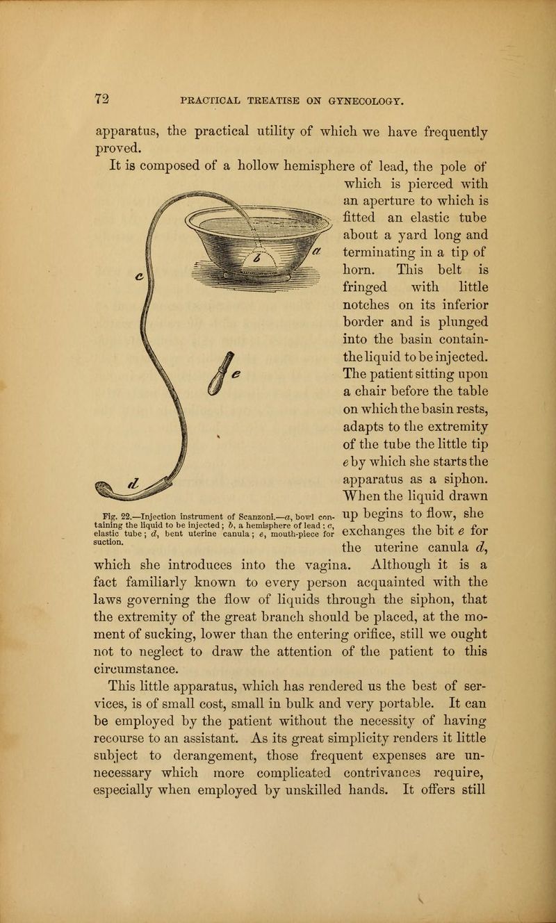 apparatus, the practical utility of which we have frequently proved. It is composed of a hollow hemisphere of lead, the pole of which is pierced with an aperture to which is fitted an elastic tube about a yard long and terminating in a tip of horn. This belt is fringed with little notches on its inferior border and is plunged into the basin contain- the liquid to be injected. The patient sitting upon a chair before the table on which the basin rests, adapts to the extremity of the tube the little tip e by which she starts the apparatus as a siphon. When the liquid drawn Fig. 22.—Injection instrument of Scanzoni.—a, bowl con- Up begmS to HOW, Slie taining the liquid to be injected ; b, a hemisphere of lead ; c, -i , i -i • i n elastic tube ; d, bent uterine canula ; e, mouth-piece for eXCIiangeS Llie OIL 6 IOI suctlon* the uterine canula d, which she introduces into the vagina. Although it is a fact familiarly known to every person acquainted with the laws governing the flow of liquids through the siphon, that the extremity of the great branch should be placed, at the mo- ment of sucking, lower than the entering orifice, still we ought not to neglect to draw the attention of the patient to this circumstance. This little apparatus, which has rendered us the best of ser- vices, is of small cost, small in bulk and very portable. It can be employed by the patient without the necessity of having recourse to an assistant. As its great simplicity renders it little subject to derangement, those frequent expenses are un- necessary which more complicated contrivances require, especially when employed by unskilled hands. It offers still