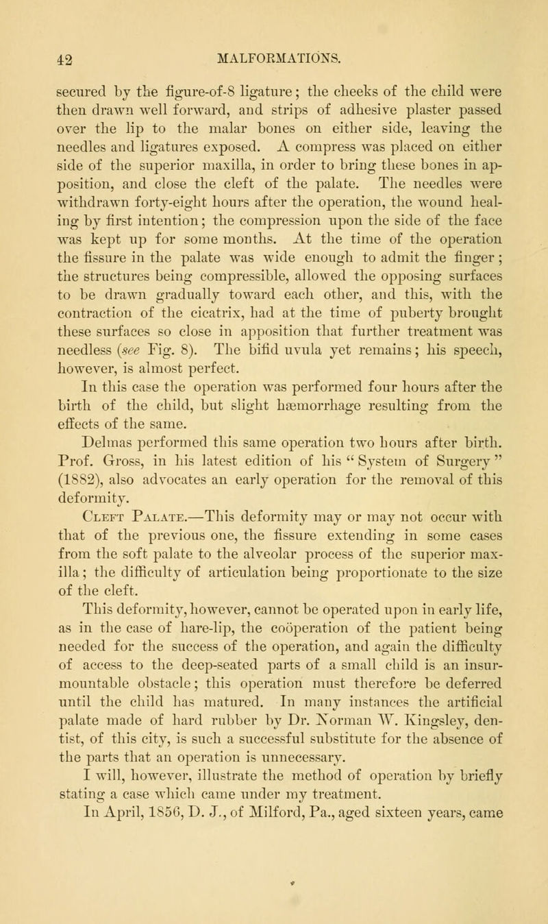 secured by the figure-of-S ligature; the cheeks of the child were then drawn well forward, and strips of adhesive plaster passed over the lip to the malar bones on either side, leaving the needles and ligatures exposed. A compress was placed on either side of the superior maxilla, in order to bring these bones in ap- position, and close the cleft of the palate. The needles were withdrawn forty-eight hours after the operation, the wound heal- ing by first intention; the compression upon the side of the face was kept up for some months. At the time of the operation the fissure in the palate was wide enough to admit the finger; the structures being compressible, allowed the opposing surfaces to be drawn gradually toward each other, and this, with the contraction of the cicatrix, had at the time of puberty brought these surfaces so close in apposition that further treatment was needless (see Fig. 8). The bifid uvula yet remains; his speech, however, is almost perfect. In this case the operation was performed four hours after the birth of the child, but slight haemorrhage resulting from the effects of the same. Delmas performed this same operation two hours after birth. Prof. Gross, in his latest edition of his  System of Surgery  (1882), also advocates an early operation for the removal of this deformity. Cleft Palate.—This deformity may or may not occur with that of the previous one, the fissure extending in some cases from the soft palate to the alveolar process of the superior max- illa ; the difficulty of articulation being proportionate to the size of the cleft. This deformity, however, cannot be operated upon in early life, as in the case of hare-lip, the cooperation of the patient being needed for the success of the operation, and again the difficulty of access to the deep-seated parts of a small child is an insur- mountable obstacle; this operation must therefore be deferred until the child has matured. In many instances the artificial palate made of hard rubber by Dr. Xorman W. Kingsley, den- tist, of this city, is such a successful substitute for the absence of the parts that an operation is unnecessary. I will, however, illustrate the method of operation by briefly stating a case which came under my treatment. In April, 1856, D. J., of Milford, Pa., aged sixteen years, came