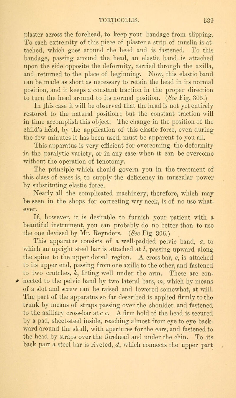 plaster across the forehead, to keep your bandage from slipping. To each extremity of this piece of piaster a strip of muslin is at- tached, which goes around the head and is fastened. To this bandage, passing around the head, an elastic band is attached upon the side opposite the deformity, carried through the axilla, and returned to the place of beginning. ]Sow, this elastic band can be made as short as necessary to retain the head in its normal position, and it keeps a constant traction in the proper direction to turn the head around to its normal position. {See Fig. 305.) In this case it will be observed that the head is not yet entirely restored to the natural position; but the constant traction will in time accomplish this object. The change in the position of the child's head, by the application of this elastic force, even during the few minutes it has been used, must be apparent to you all. This apparatus is very efficient for overcoming the deformity in the paralytic variety, or in any case when it can be overcome without the operation of tenotomy. The principle which should govern you in the treatment of this class of cases is, to supply the deficiency in muscular power by substituting elastic force. ^Nearly all the complicated machinery, therefore, which may be seen in the shops for correcting wry-neck, is of no use what- ever. If, however, it is desirable to furnish your patient with a beautiful instrument, you can probably do no better than to use the one devised by Mr. Reynders. {See Fig. 306.) This apparatus consists of a well-padded pelvic band, a, to which an upright steel bar is attached at I, passing upward along the spine to the upper dorsal region. A cross-bar, c, is attached to its upper end, passing from one axilla to the other, and fastened to two crutches, h, fitting well under the arm. These are con- nected to the pelvic band by two lateral bars, m, which by means of a slot and screw can be raised and lowered somewhat, at will. The part of the apparatus so far described is applied firmly to the trunk by means of straps passing over the shoulder and fastened to the axillary cross-bar at c c. A firm hold of the head is secured by a pad, sheet-steel inside, reaching almost from eye to eye back- ward around the skull, with apertures for the ears, and fastened to the head by straps over the forehead and under the chin. To its back part a steel bar is riveted, d, which connects the upper part