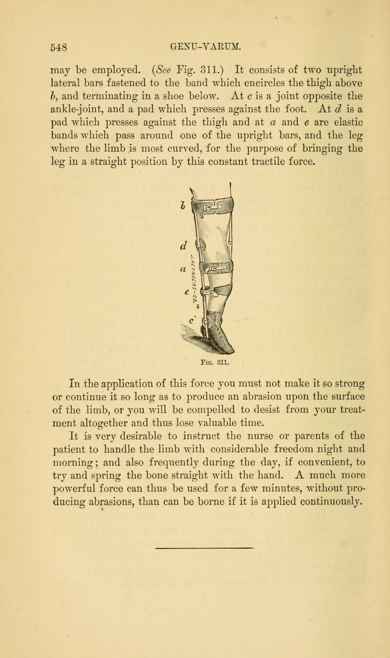 may be employed. (See Fig. 311.) It consists of two upright lateral bars fastened to the band which encircles the thigh above b, and terminating in a shoe below. At c is a joint opposite the ankle-joint, and a pad which presses against the foot. At d is a pad which presses against the thigh and at a and e are elastic bands which pass around one of the upright bars, and the leg where the limb is most curved, for the purpose of bringing the leg in a straight position by this constant tractile force. Fig. 311. In the application of this force you must not make it so strong or continue it so long as to produce an abrasion upon the surface of the limb, or you will be compelled to desist from your treat- ment altogether and thus lose valuable time. It is very desirable to instruct the nurse or parents of the patient to handle the limb with considerable freedom night and morning; and also frequently during the day, if convenient, to try and spring the bone straight with the hand. A much more powerful force can thus be used for a few minutes, without pro- ducing abrasions, than can be borne if it is applied continuously.