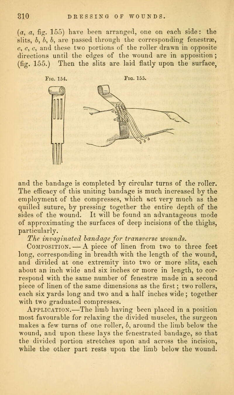 (a, a, fig. 155) have been arranged, one on each side: the slits, b, b, b, are passed through the corresponding fenestra, e?, c, <?, and these two portions of the roller drawn in opposite directions until the edges of the wound are in apposition ; (fig. 155.) Then the slits are laid flatly upon the surface. Fig. 154. Fig. 155. and the bandage is completed by circular turns of the roller. The efficacy of this uniting bandage is much increased by the employment of the compresses, which act very much as the quilled suture, by pressing together the entire depth of the sides of the wound. It will be found an advantageous mode of approximating the surfaces of deep incisions of the thighs, particularly. The invaginated bandage for transverse wounds. Composition. — A piece of linen from two to three feet long, corresponding in breadth with the length of the wound, and divided at one extremity into two or more slits, each about an inch wide and six inches or more in length, to cor- respond with the same number of fenestra made in a second piece of linen of the same dimensions as the first; two rollers, each six yards long and two and a half inches wide; together with two graduated compresses. Application.—The limb having been placed in a position most favourable for relaxing the divided muscles, the surgeon makes a few turns of one roller, b, around the limb below the wound, and upon these lays the fenestrated bandage, so that the divided portion stretches upon and across the incision, while the other part rests upon the limb below the wound.