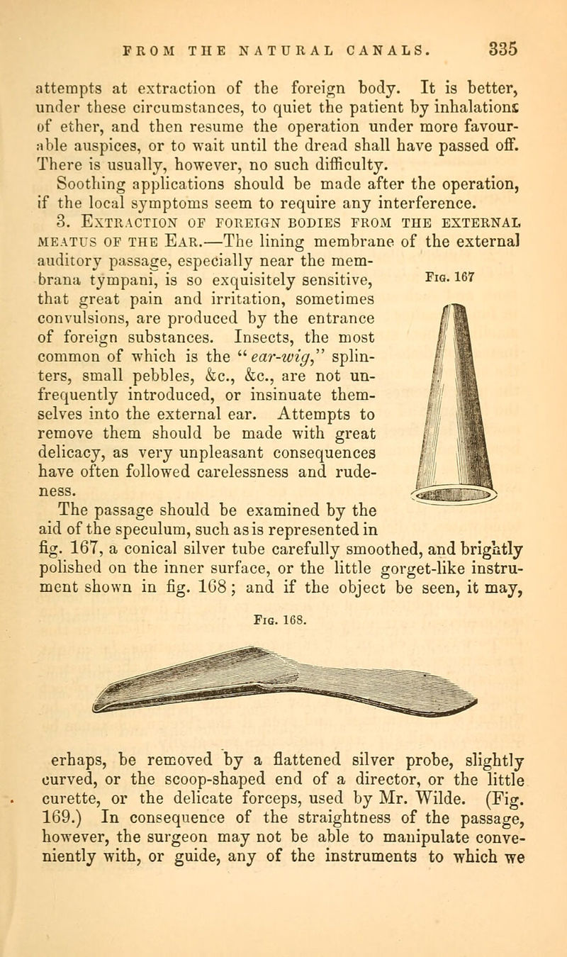 Fig. 167 attempts at extraction of the foreign body. It is better, under these circumstances, to quiet the patient by inhalations of ether, and then resume the operation under more favour- able auspices, or to wait until the dread shall have passed off. There is usually, however, no such difficulty. Soothing applications should be made after the operation, if the local symptoms seem to require any interference. 3. Extraction of foreign bodies from the external meatus of the Ear.—The lining membrane of the external auditory passage, especially near the mem- brana tympani, is so exquisitely sensitive, that great pain and irritation, sometimes convulsions, are produced by the entrance of foreign substances. Insects, the most common of which is the ear-wig, splin- ters, small pebbles, &c, &c, are not un- frequently introduced, or insinuate them- selves into the external ear. Attempts to remove them should be made with great delicacy, as very unpleasant consequences have often followed carelessness and rude- ness. The passage should be examined by the aid of the speculum, such as is represented in fig. 167, a conical silver tube carefully smoothed, and brightly polished on the inner surface, or the little gorget-like instru- ment shown in fig. 1G8; and if the object be seen, it may, Fig. 168. erhaps, be removed by a flattened silver probe, slightly curved, or the scoop-shaped end of a director, or the little curette, or the delicate forceps, used by Mr. Wilde. (Eig. 169.) In consequence of the straightness of the passage, however, the surgeon may not be able to manipulate conve- niently with, or guide, any of the instruments to which we