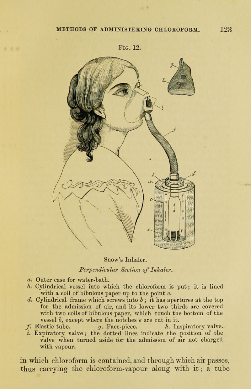 Fia. 12. Snow's Inhaler. Perpendicular Section of Inhaler. a. Outer ease for water-bath. h. Cylindrical vessel into which the chloroform is put; it is lined with a coil of bibulous paper up to the point c. d. Cylindrical frame which screws into b; it has apertures at the top for the admission of air, and its lower two thirds are covered with two coils of bibulous paper, which touch the bottom of the vessel b, except where the notches e are cut in it. y. Elastic tube. g. Face-piece. h. Inspiratory valve. i. Expiratory valve; the dotted lines indicate the position of the valve when turned aside for the admission of air not charged with vapour. in which chloroform is contained, and through which air passes, thus carrying the chloroform-vapour along with it; a tube