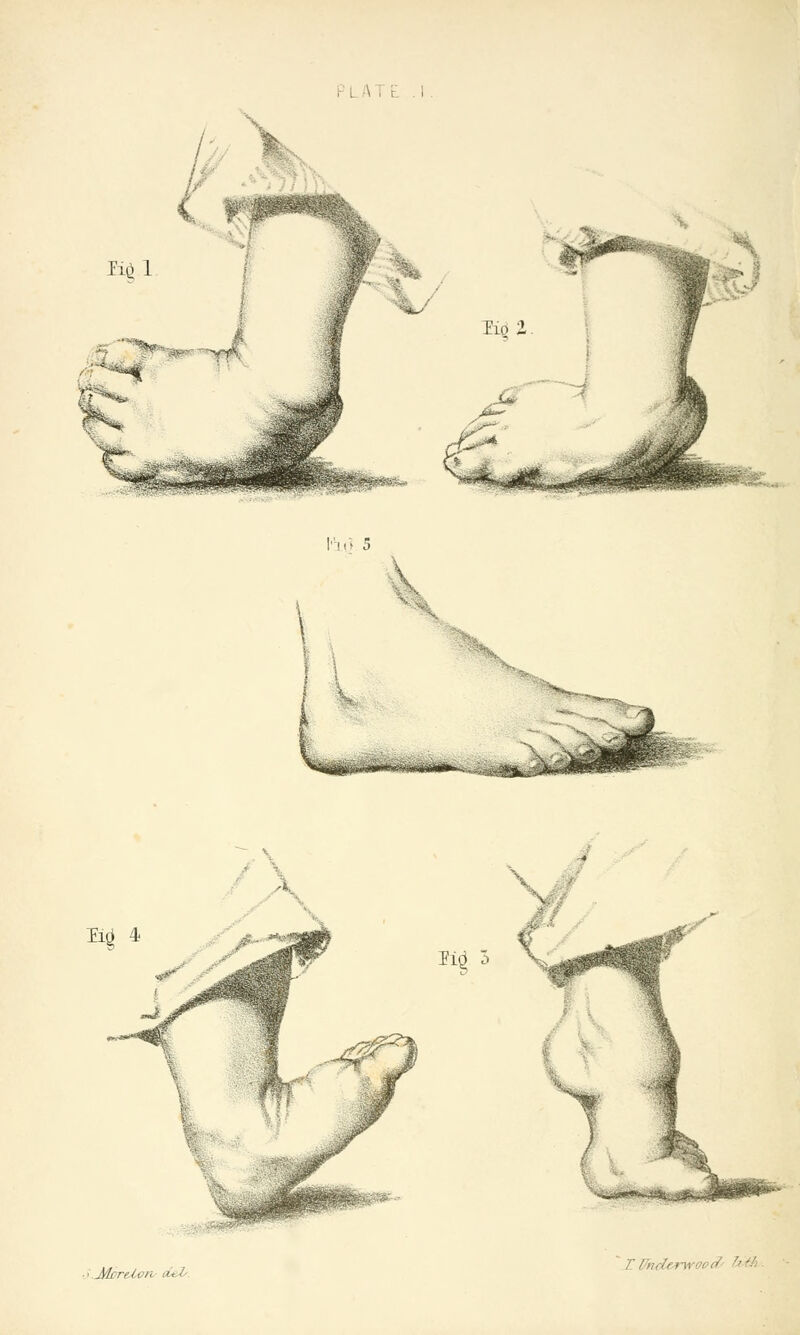 lig 4 m 3 Jylrreivr, i. ZVncL > woea rM