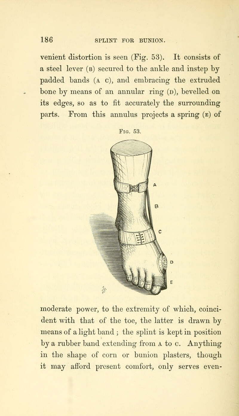 venient distortion is seen (Fig. 53). It consists of a steel lever (b) secured to the ankle and instep by padded bands (a. c), and embracing the extruded bone by means of an annular ring (d), bevelled on its edges, so as to fit accurately the surrounding parts. From this annulus projects a spring (e) of Pig. 53. moderate power, to the extremity of which, coinci- dent with that of the toe, the latter is drawn by means of a light band ; the splint is kept in position by a rubber band extending from a to c. Anything in the shape of corn or bunion plasters, though it may afford present comfort, only serves even-