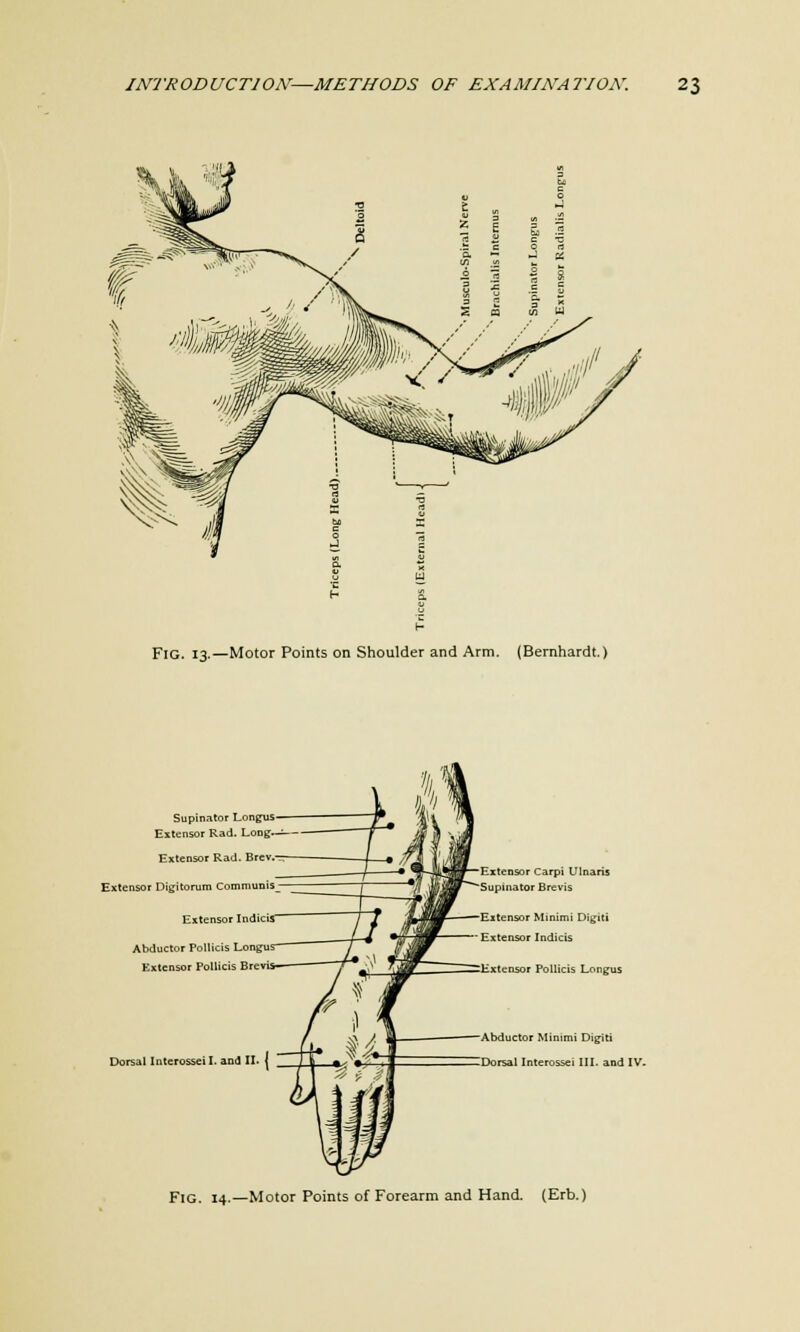 Fig, J3.—Motor Points on Shoulder and Arm. (Bernhardt.) Supinator Longus Extensor Rad. Long—— Extensor Rad. Brcv. Extensor Digitorum Communis Extensor IndiciS Abductor Pollicis Longu Extensor Pollicis Bre Dorsal Interosseil. and II Extensor Carpi Ulnaris Supinator Brevis Extensor Minimi Digiti Extensor Indicis Extensor Pollicis Longus Abductor Minimi Digiti Dorsal Interossei III. and IV. Fig. 14.—Motor Points of Forearm and Hand. (Erb.)